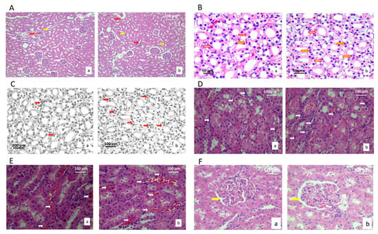 81a stain example for stereology 81a stain example for stereology