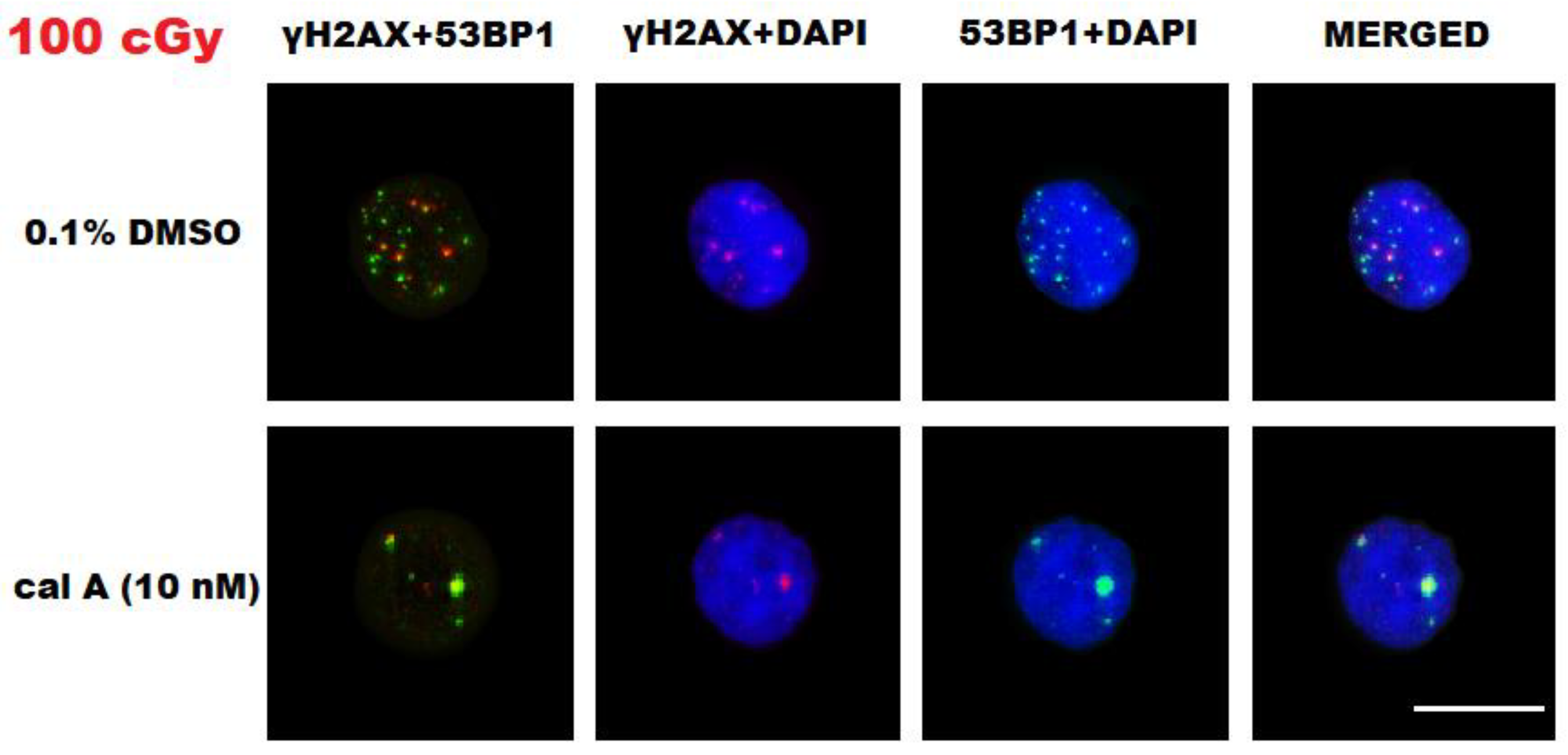 Evaluation of Calyculin A Effect on γH2AX/53BP1 Focus