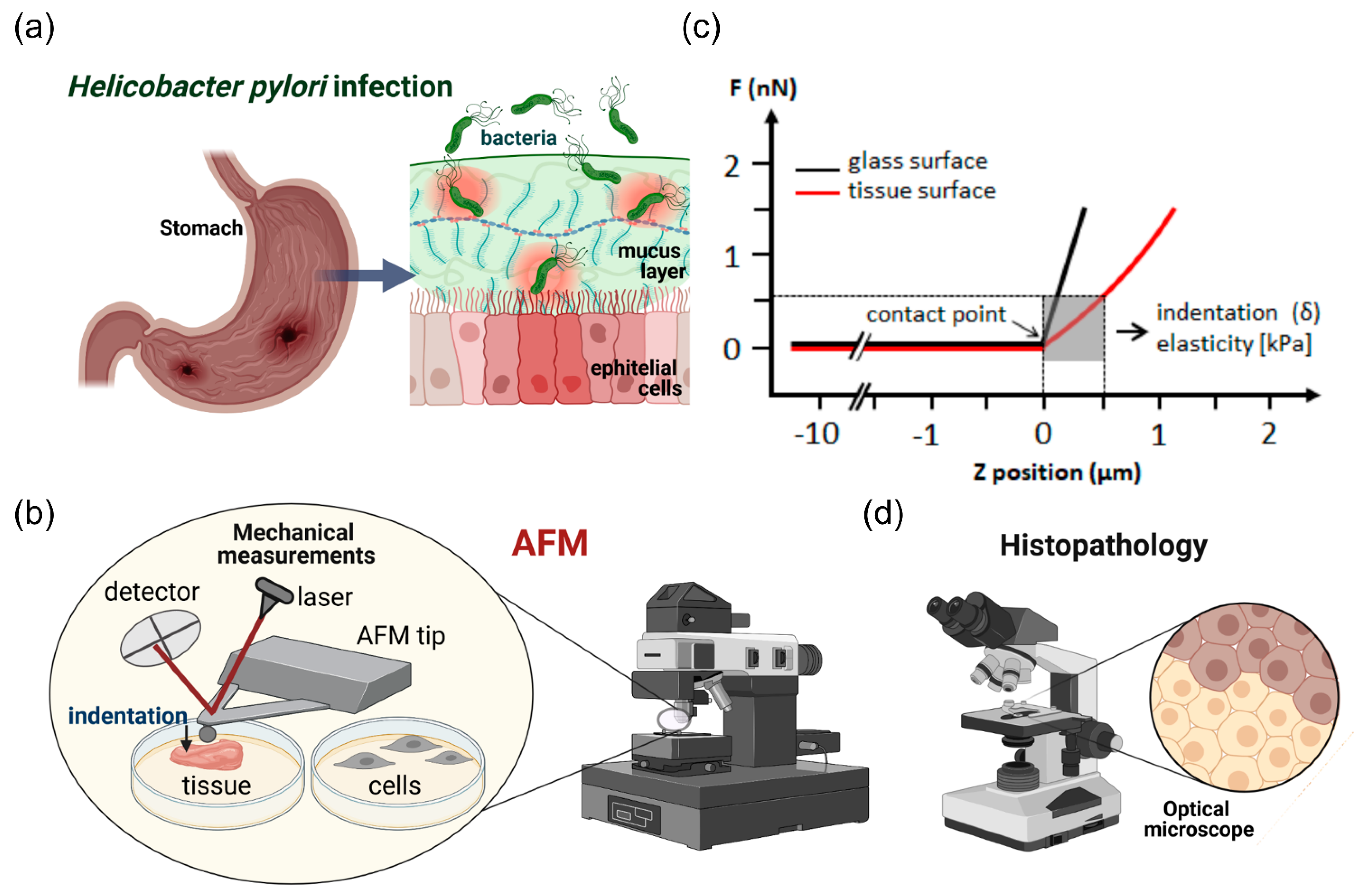 Helicobacter pylori tratamiento antibiótico efectos secundarios