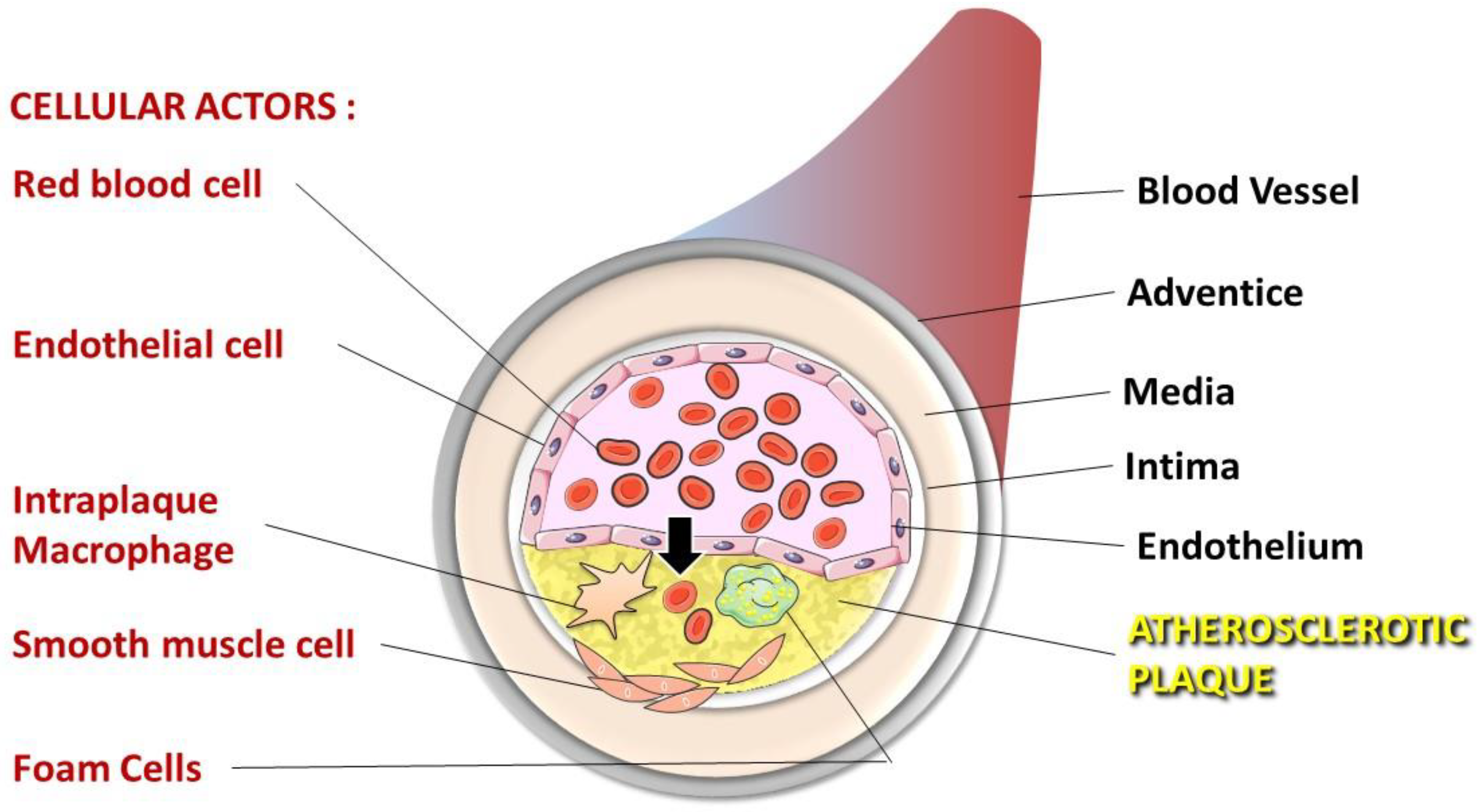 IJMS | Free Full-Text | Erythrocytes: Central Actors in Multiple Scenes of  Atherosclerosis