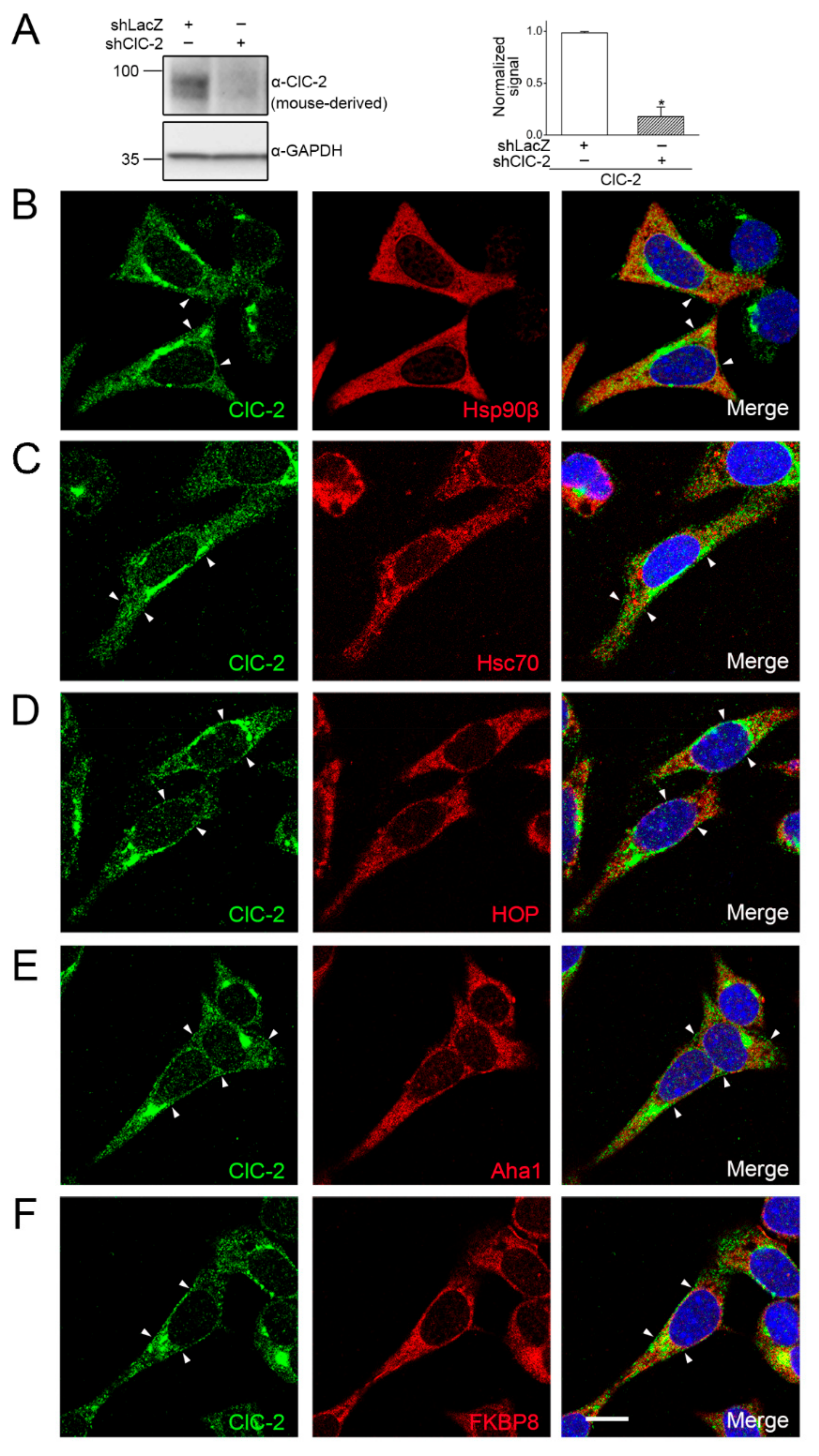 Ijms 22 05859 g002 Ijms 22 05859 g002