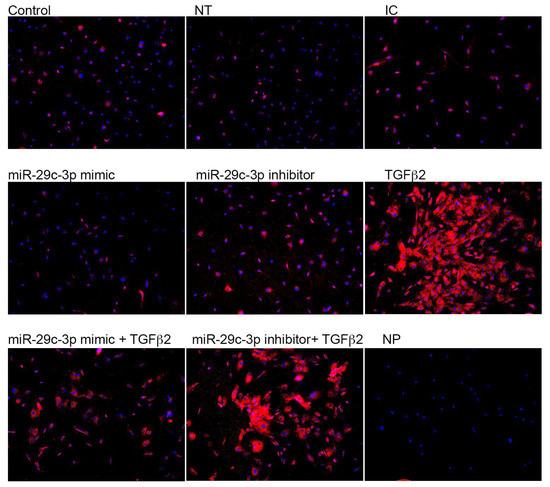Mirna Expression in Glaucomatous and TGFβ2 Treated Lamina Cribrosa Cells
