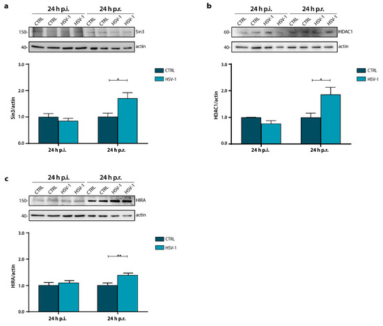 Herpes Simplex Virus-1 in the Brain: The Dark Side of a Sneaky Infection:  Trends in Microbiology