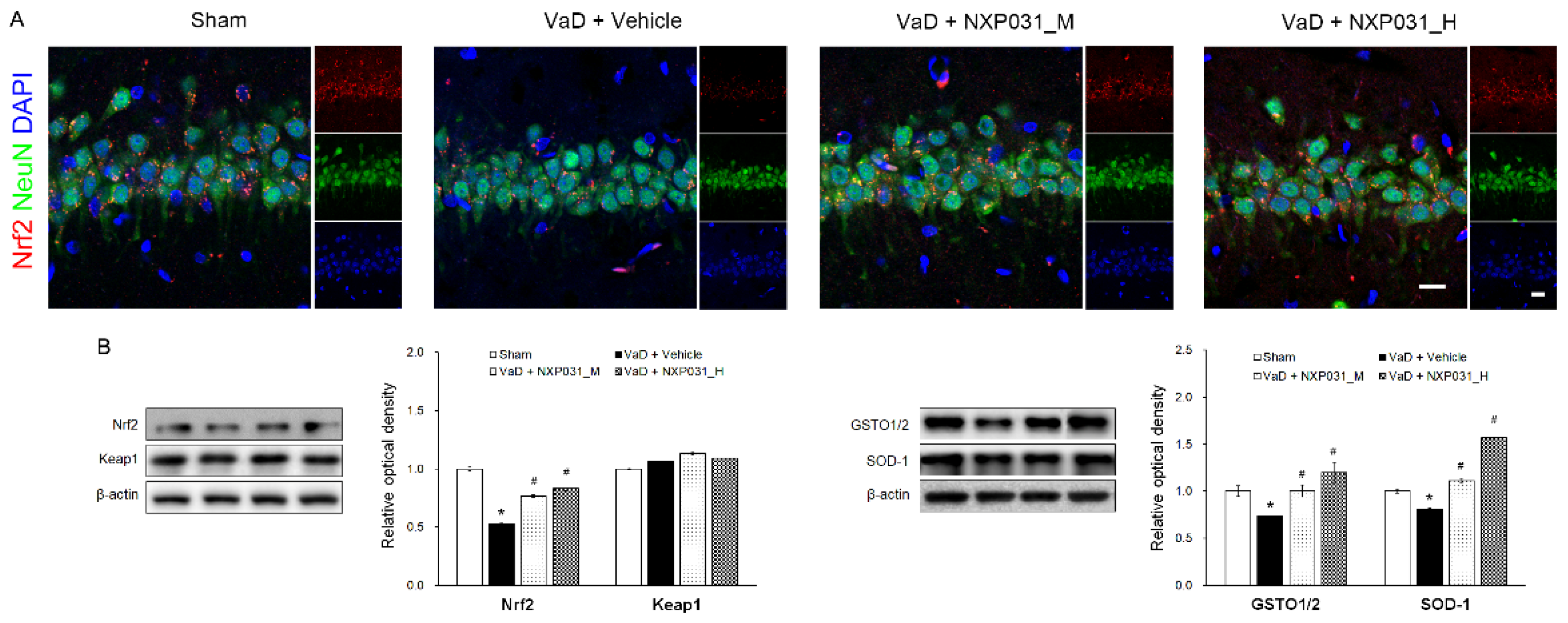 Ijms 22 06285 g004 Ijms 22 06285 g004