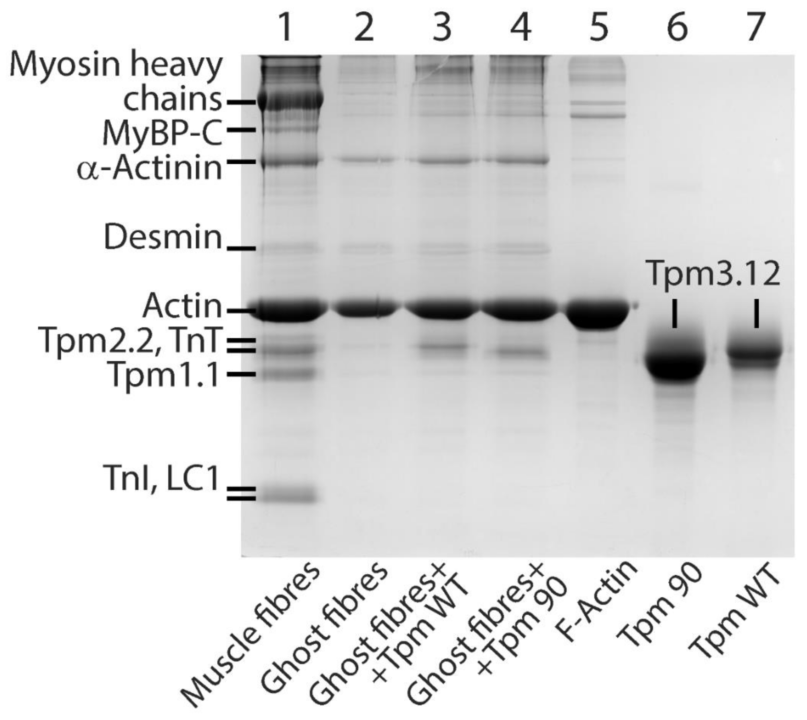 Ijms Free Full Text Molecular Mechanisms Of The Deregulation Of Muscle Contraction Induced By The R90p Mutation In Tpm3 12 And The Weakening Of This Effect By m And W7