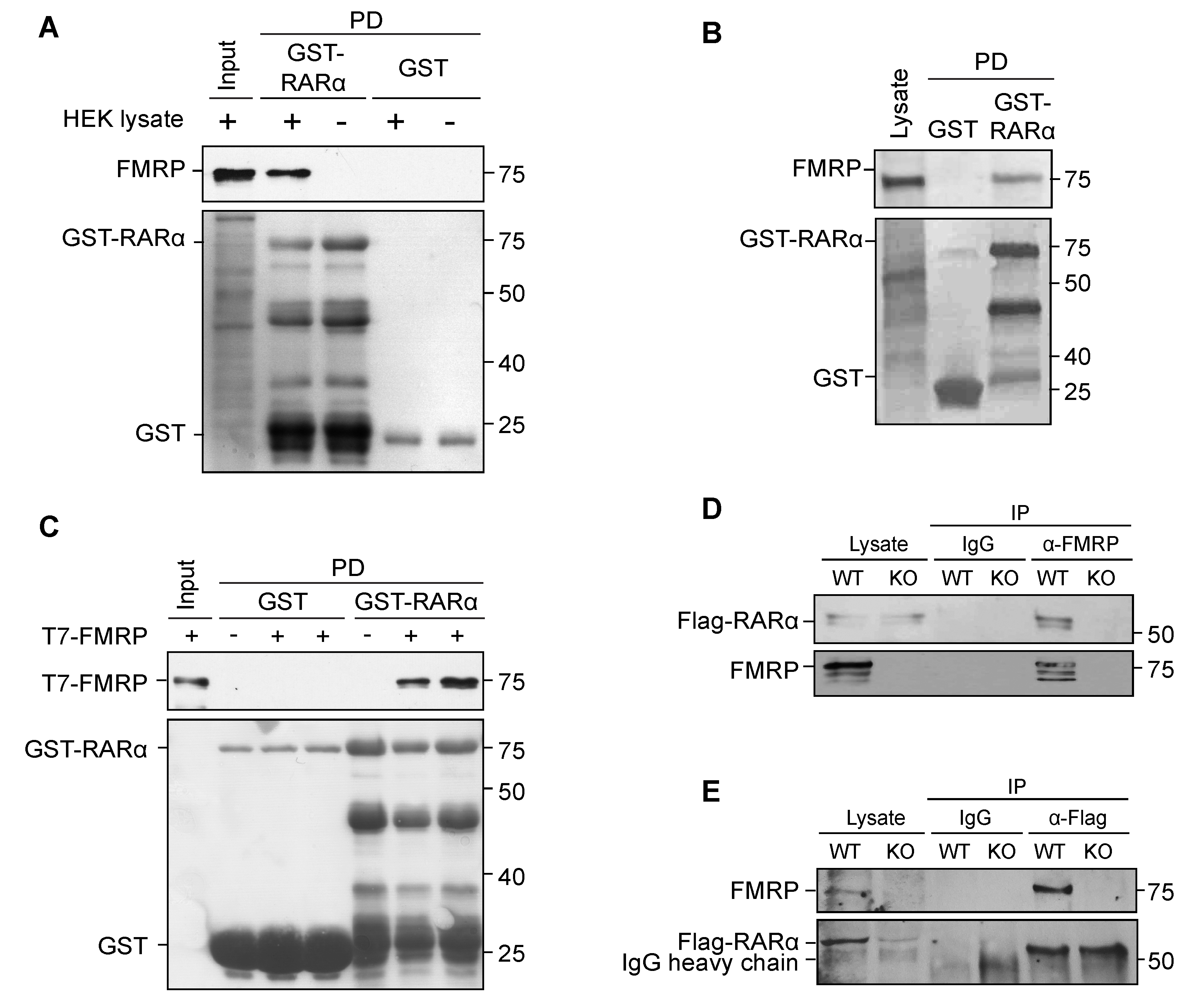 Local Protein Synthesis and Spine Morphogenesis: Fragile X Syndrome and  Beyond