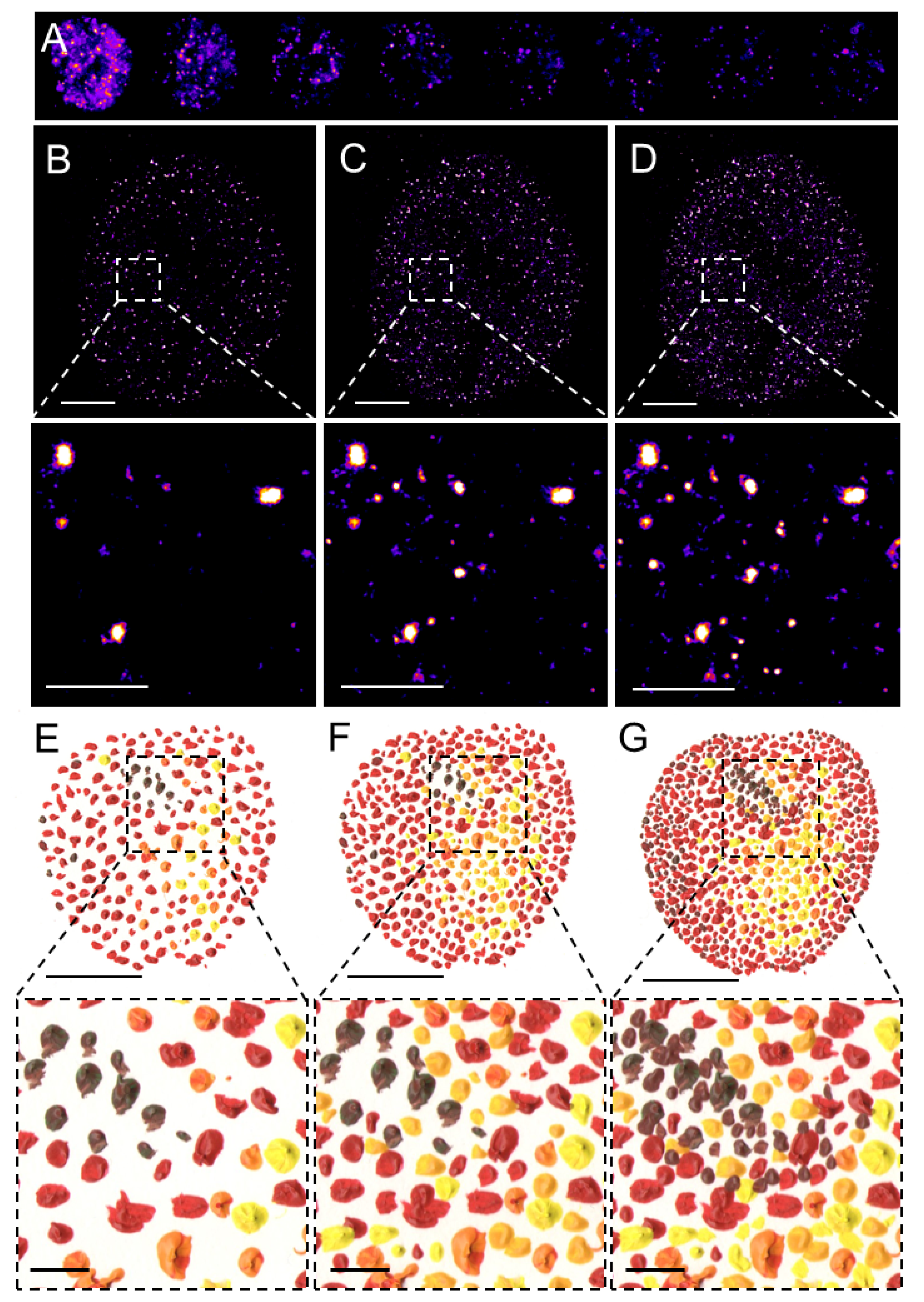 Pointillistic nature of single-molecule localization microscopy. (A) Individual frames from the time-lapse acquisition of raw blinking of Alexa Fluor (AF)647-labeled secondary antibody against primary anti-RNAPII antibody (RNAPII-AF647). The signal of individual AF647 molecules accumulates in time (B,C) to create the final dSTORM image of RNAPII (C). The imaging process in (B–D) resembles an artistic painting style called pointillism in which the accu-mulation of color spots on a canvas (E,F) creates the final painting (G). Artistic paintings in (E–G) were kindly provided by Katarína Mrvová. White bar = 5 µm; inset 1 µm. Black bar = 5 cm; inset 1 cm.