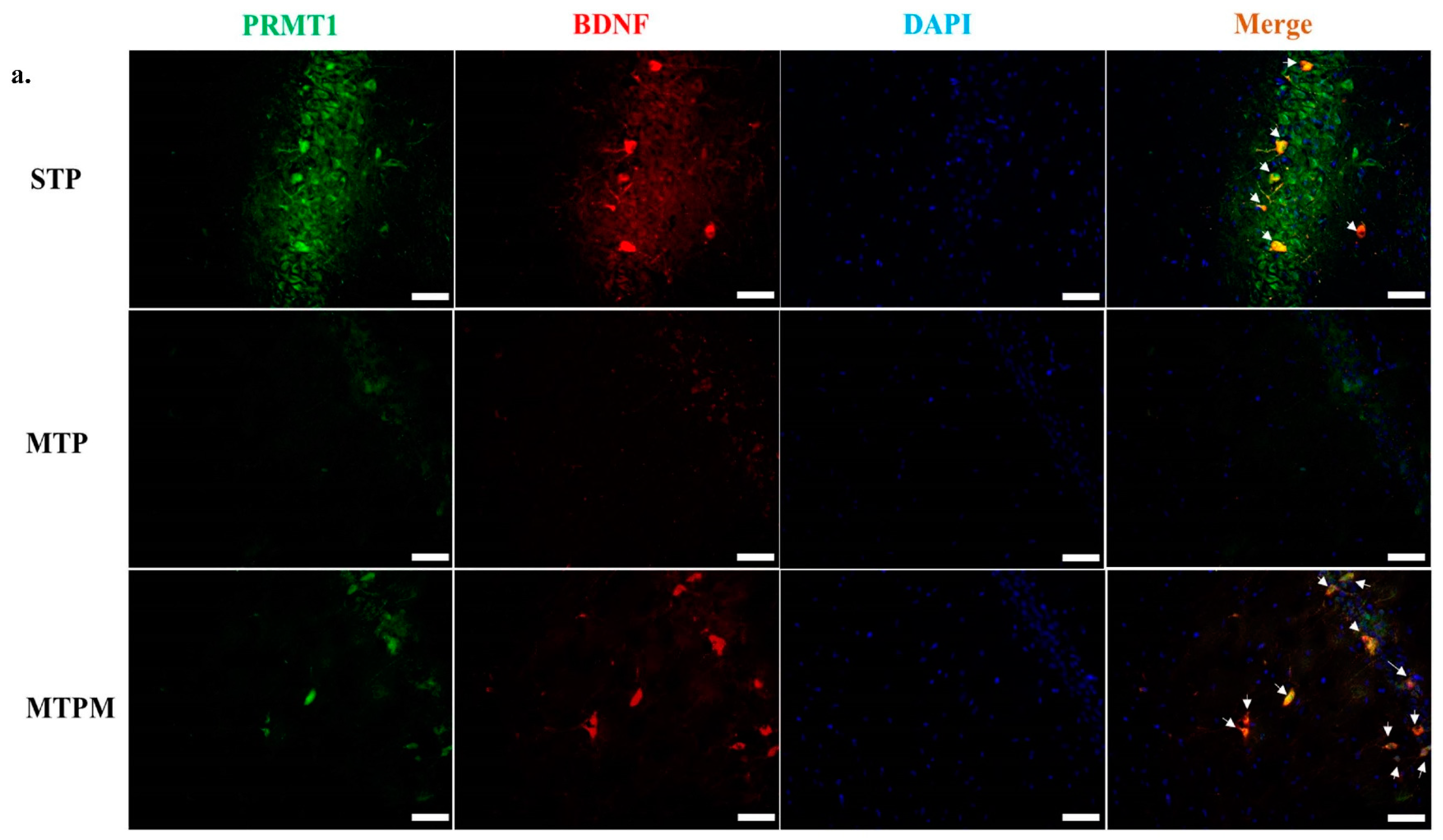 Ijms 22 06718 g005a 550