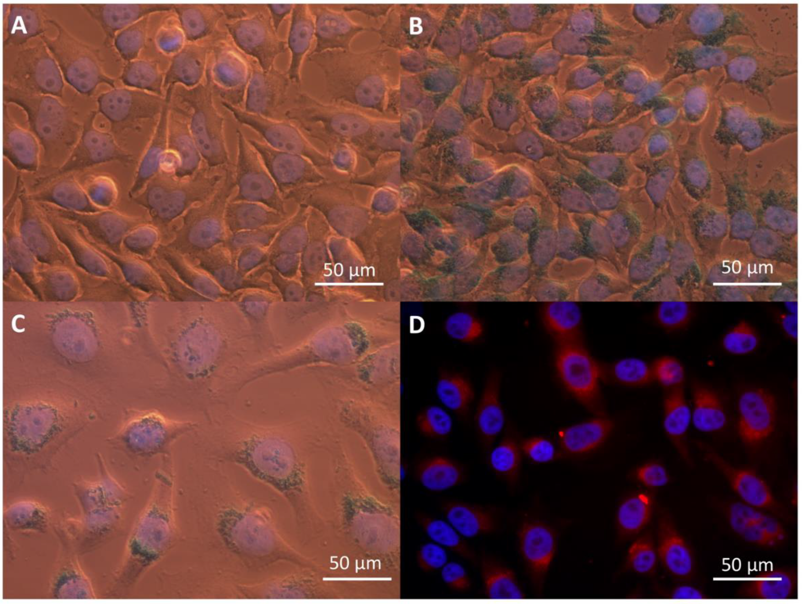 Intracellular Delivery of Doxorubicin by Iron Oxide-Based