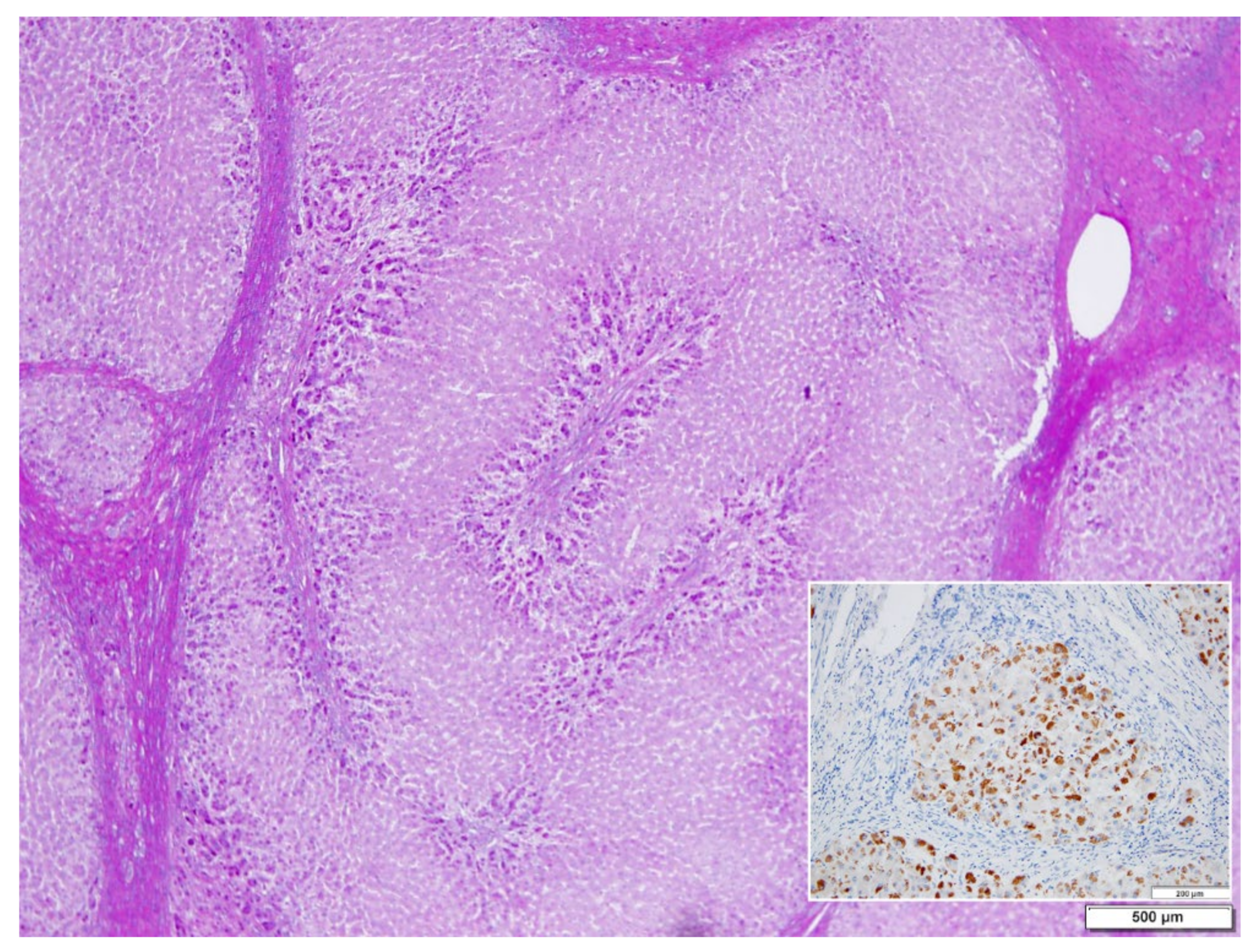 Ijms 22 06807 g005 550