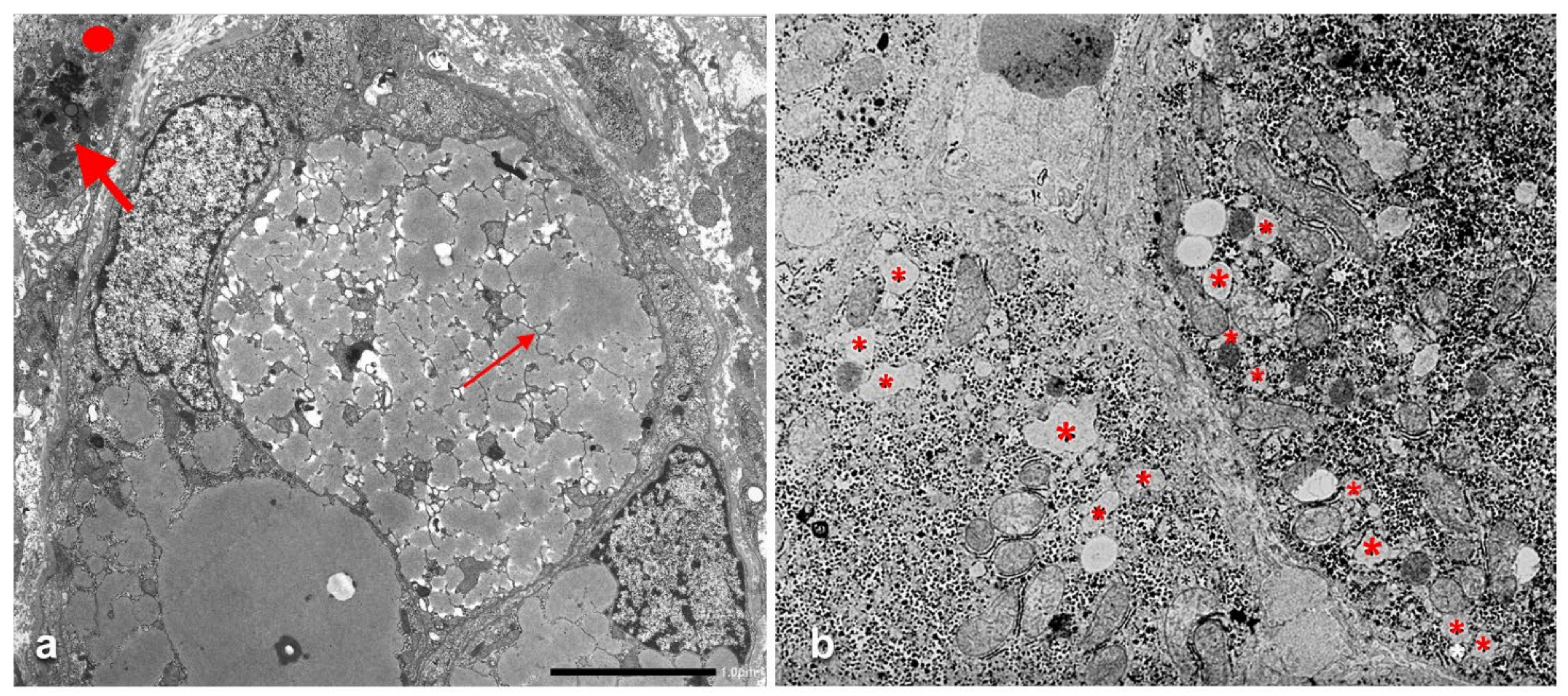 Ijms 22 06807 g010 550