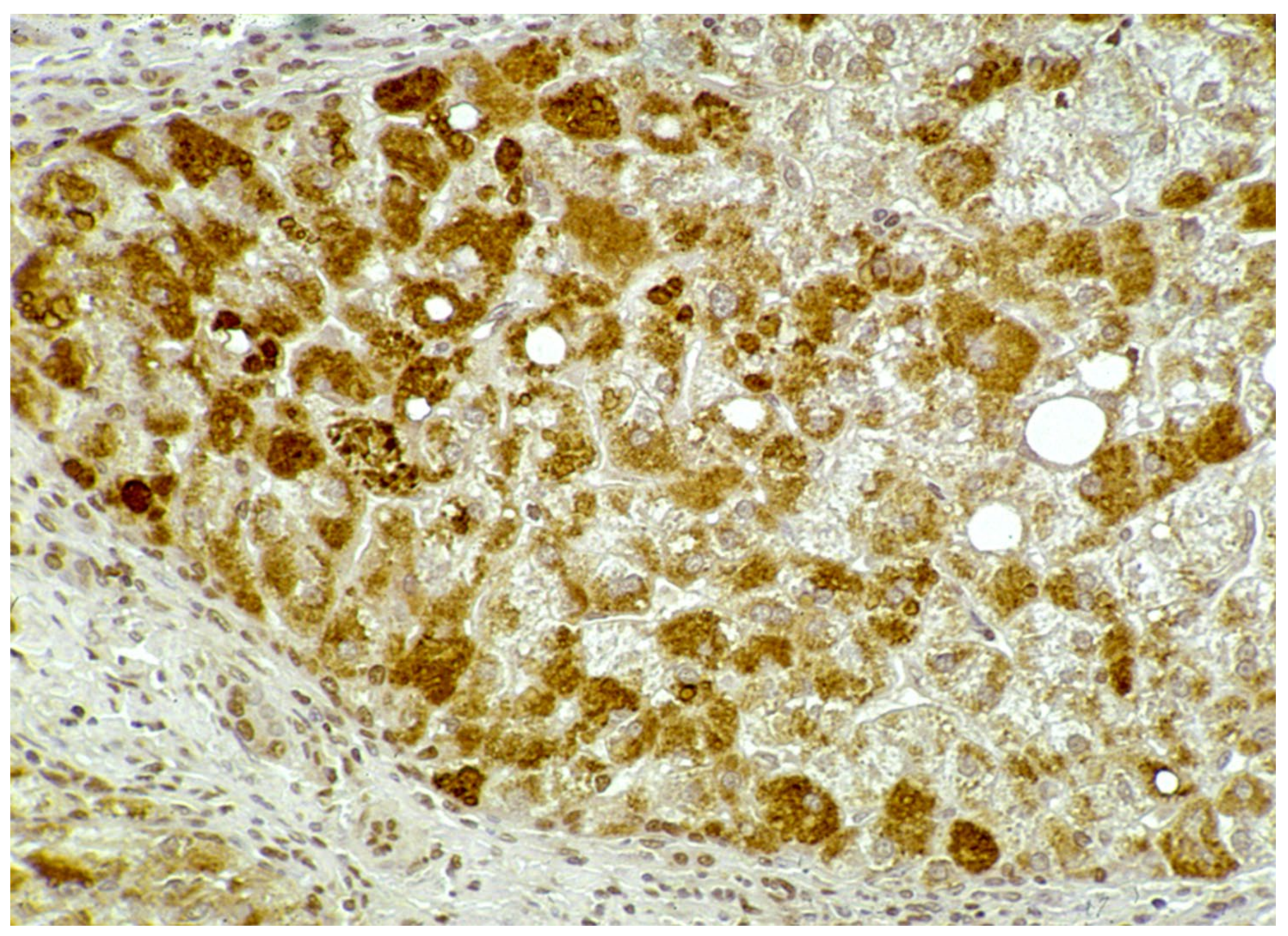 Ijms 22 06807 g014 550