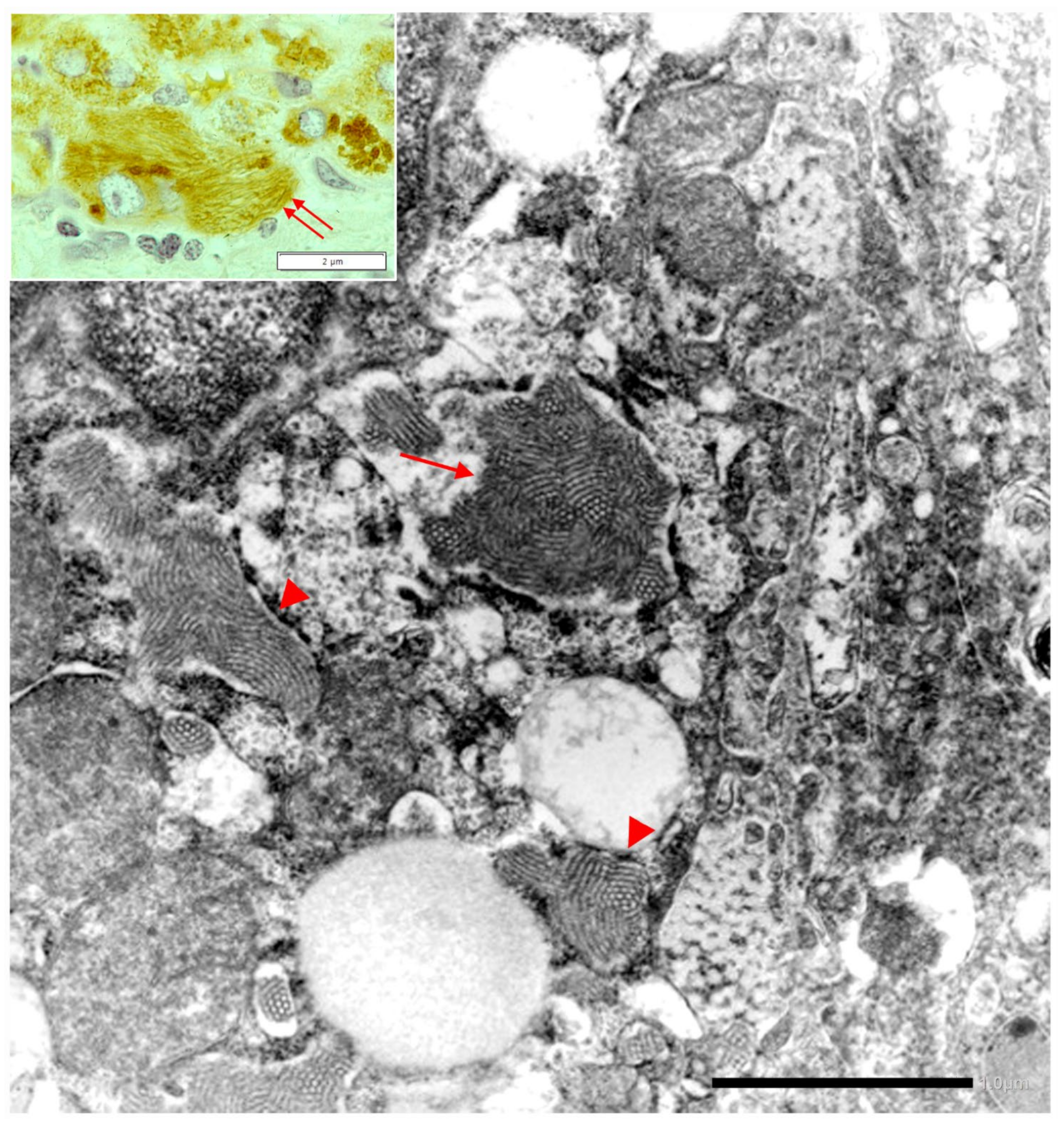 Ijms 22 06807 g016 550