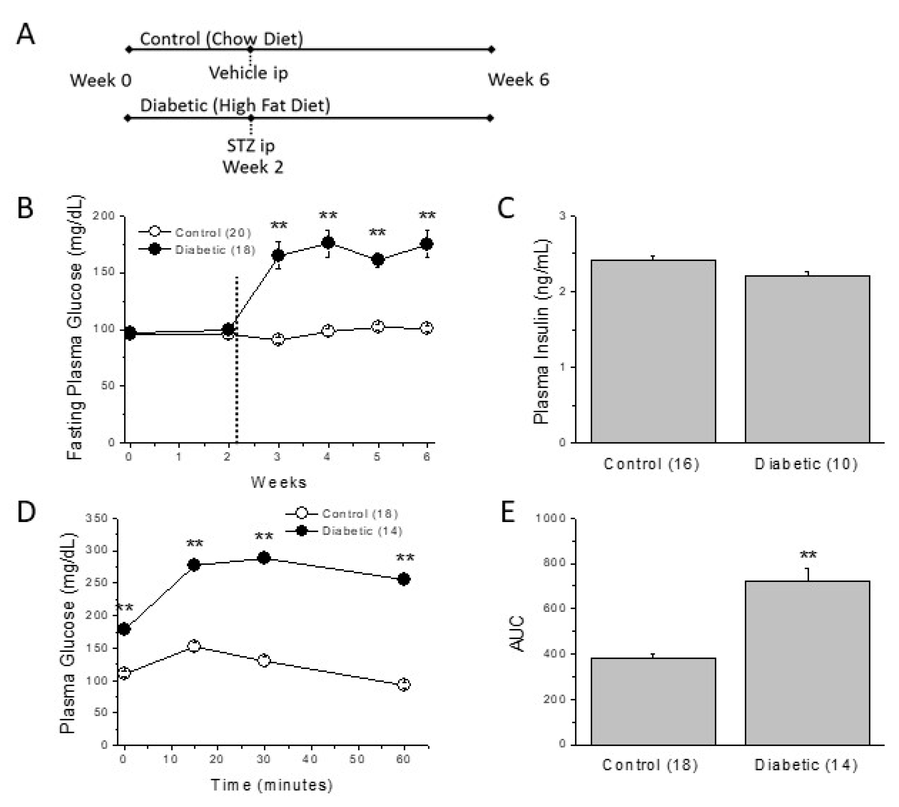 ventricular tachycardia type 2 diabetes