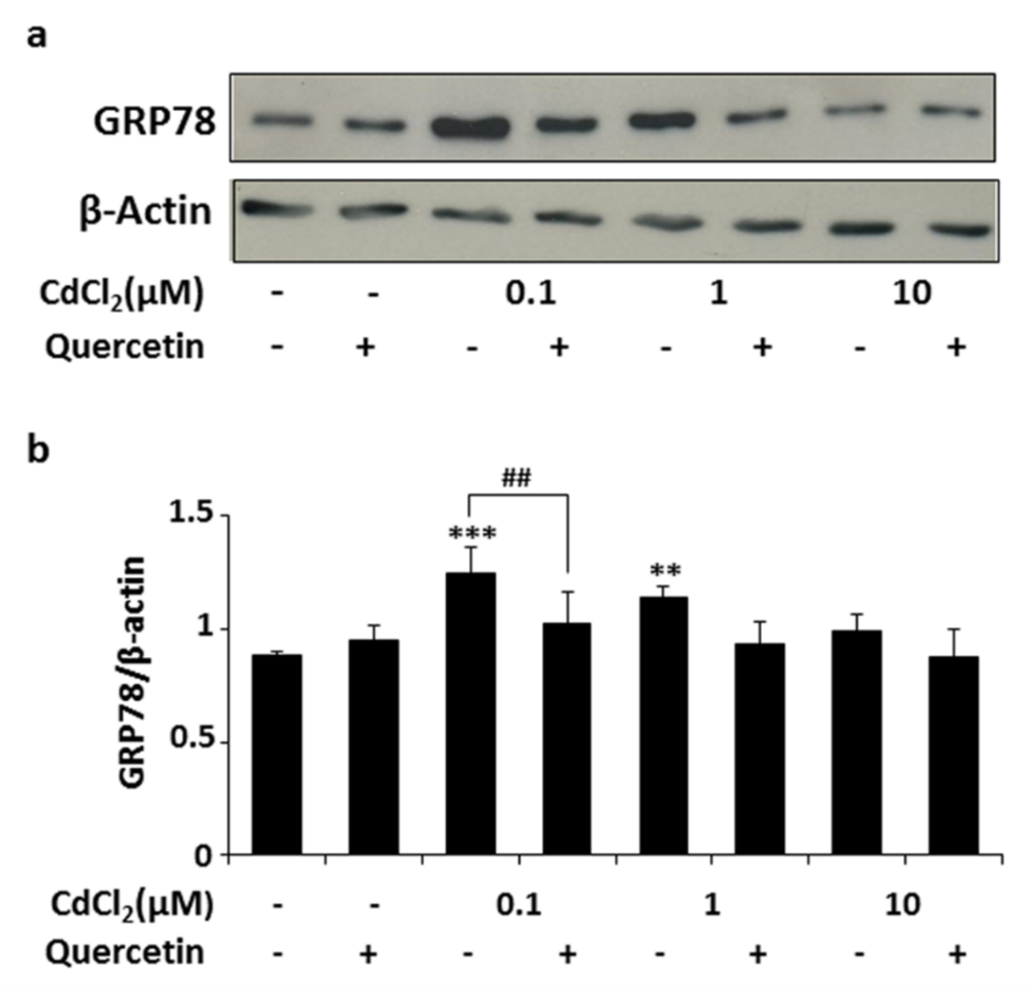 Ijms 22 06849 g005 550