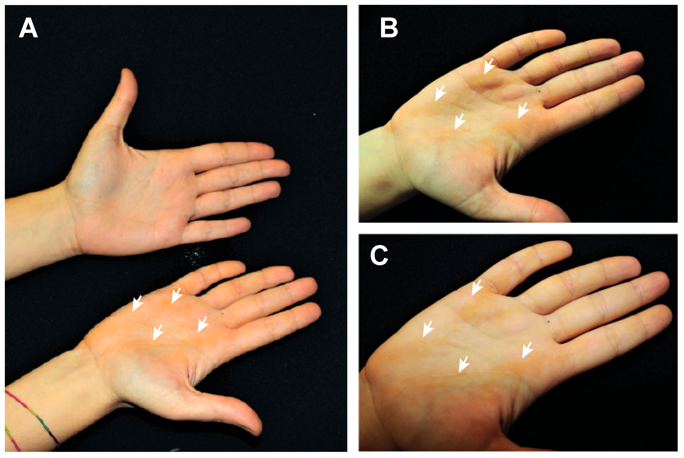 Ijms 22 06901 g001 550