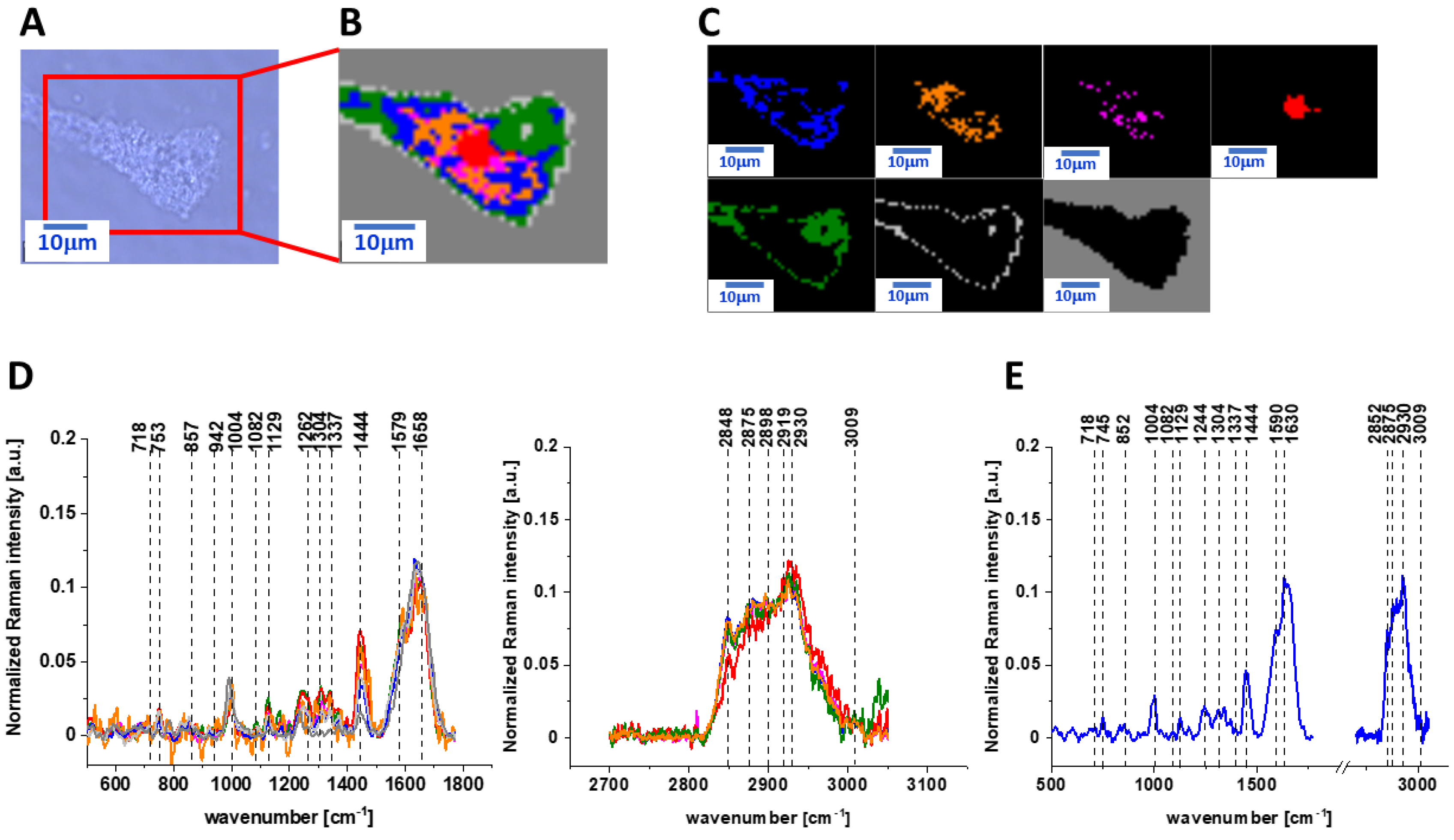 Ijms Free Full Text Vitamin C Protective Role In Oxidative Stress Conditions Induced In Human Normal Colon Cells By Label Free Raman Spectroscopy And Imaging Html Ijms Free Full Text Vitamin C Protective Role In Oxidative Stress Conditions Induced In Human Normal Colon Cells By Label Free Raman Spectroscopy And Imaging Html