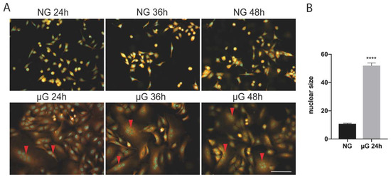 Simulated Microgravity Effects on Human Adenocarcinoma