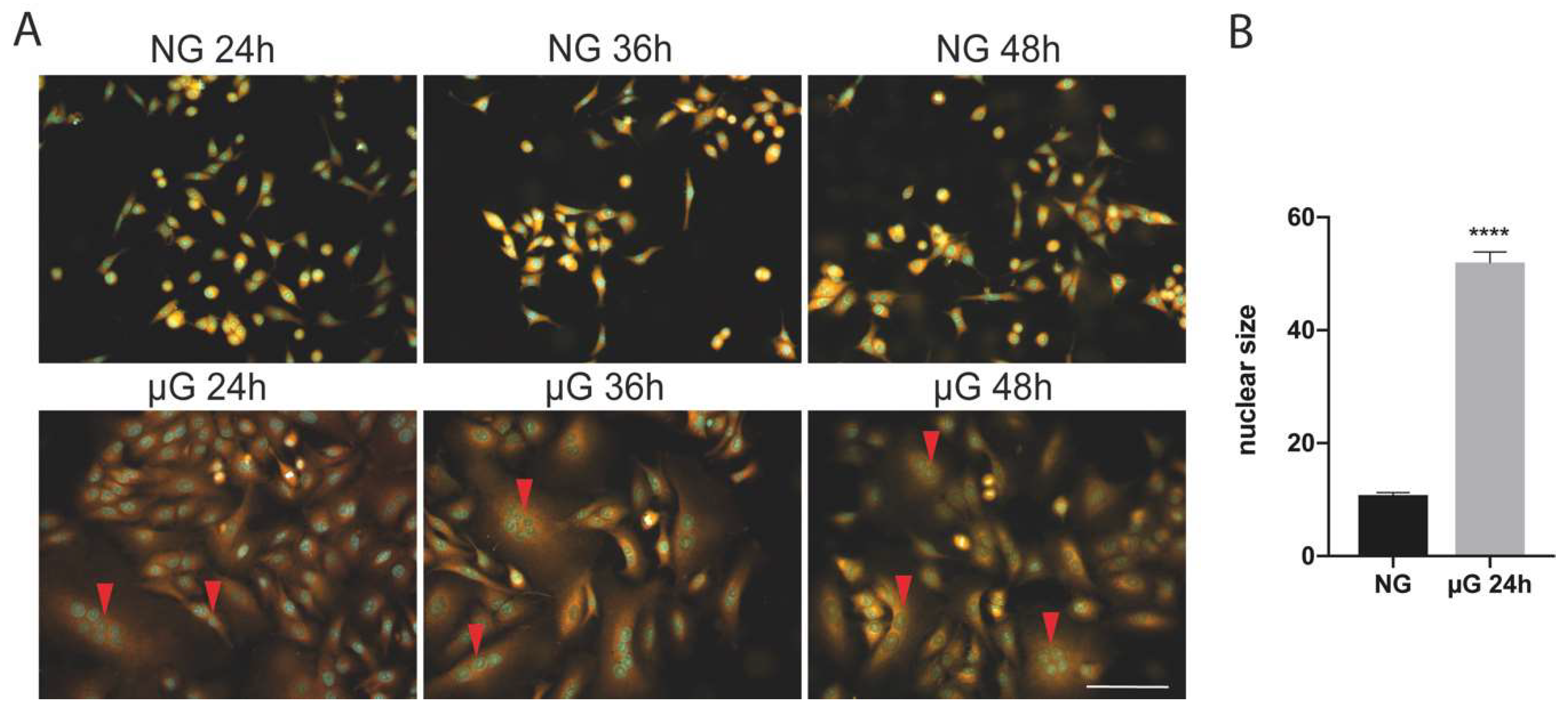 Simulated Microgravity Effects on Human Adenocarcinoma Simulated Microgravity Effects on Human Adenocarcinoma