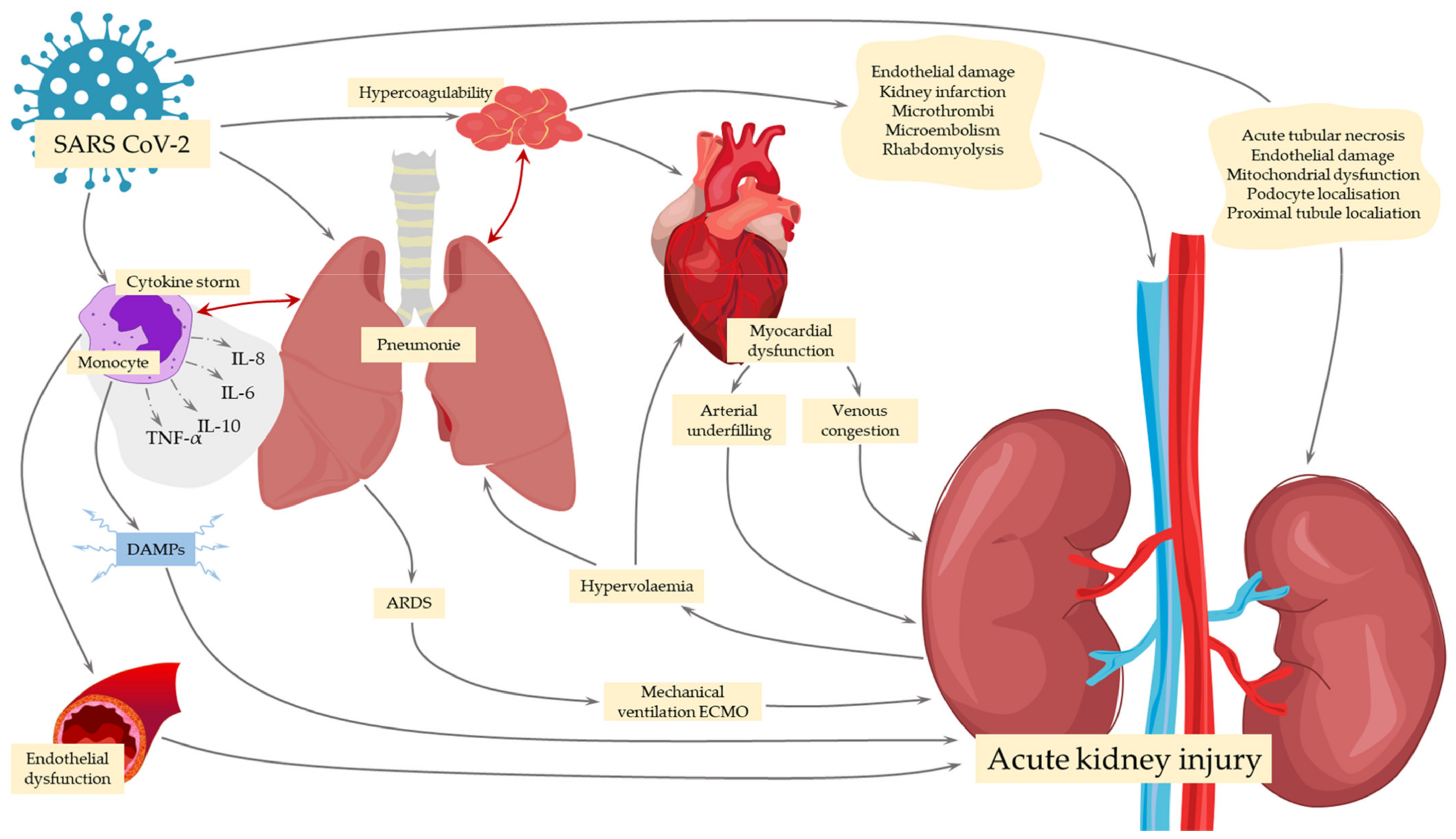 Ijms Free Full Text Pathophysiology And Clinical Manifestations Of Covid 19 Related Acute Kidney Injury The Current State Of Knowledge And Future Perspectives Html Ijms Free Full Text Pathophysiology And Clinical Manifestations Of Covid 19 Related Acute Kidney Injury The Current State Of Knowledge And Future Perspectives Html