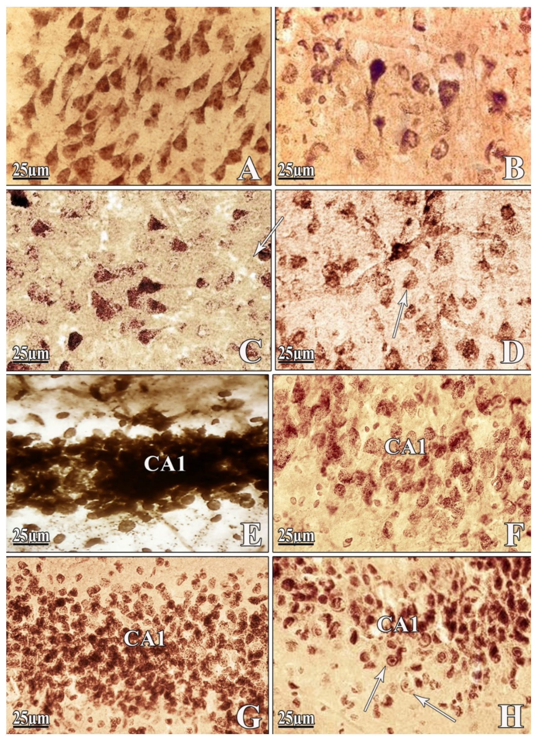 Ijms 22 07084 g003 550