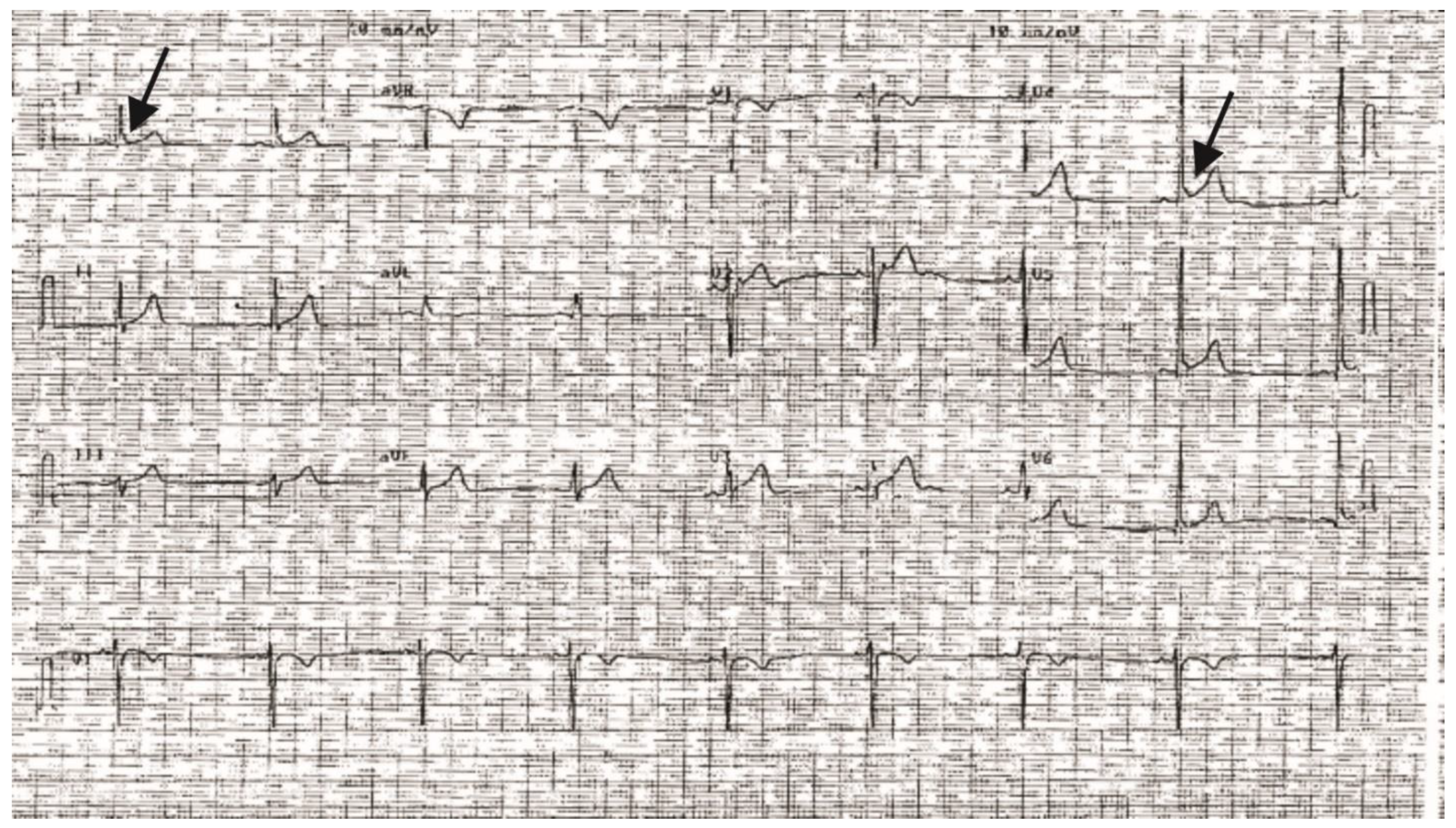 Ijms 22 07108 g001