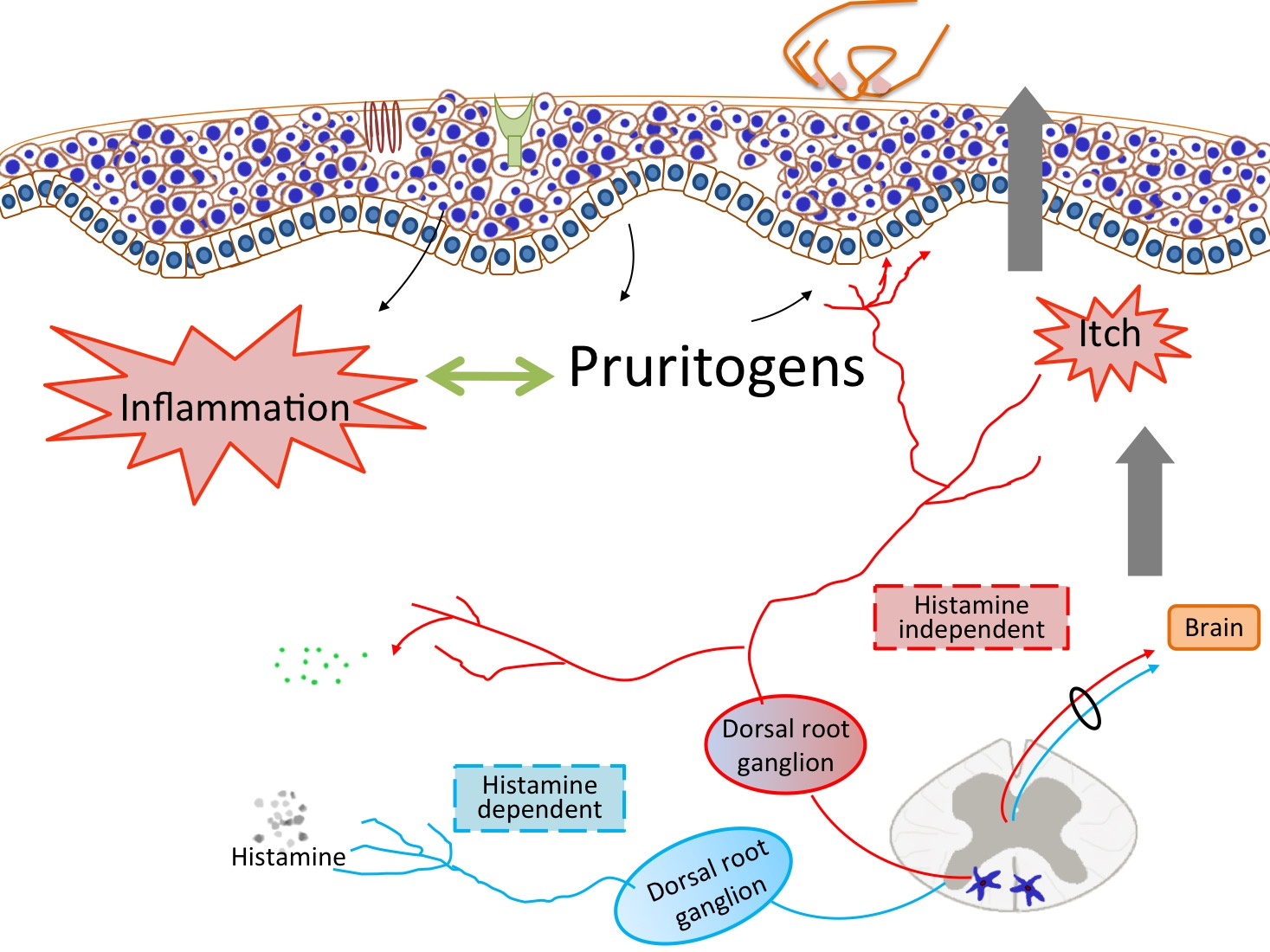 gabapentin uremic pruritus