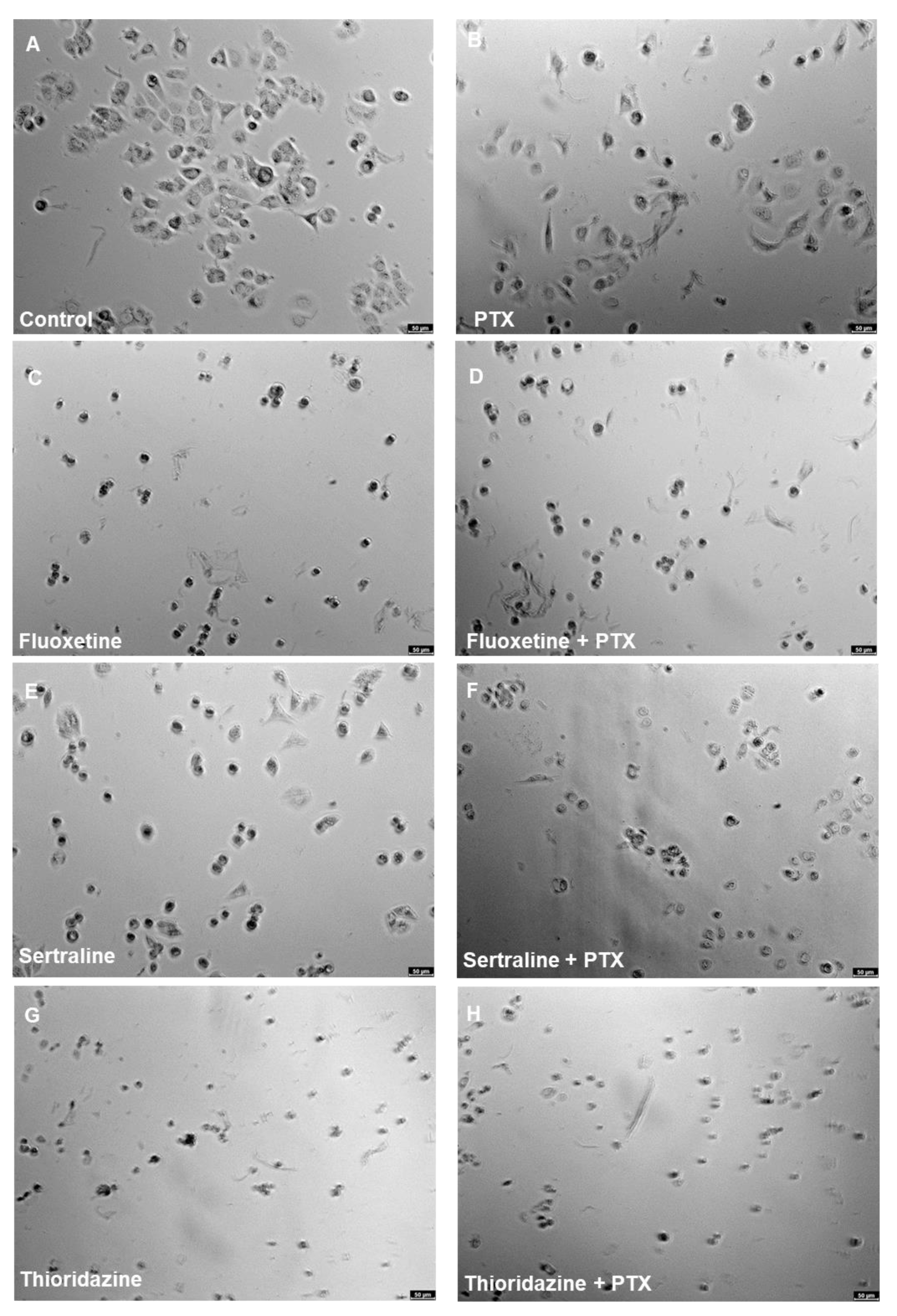 Ijms 22 07408 g016a 550