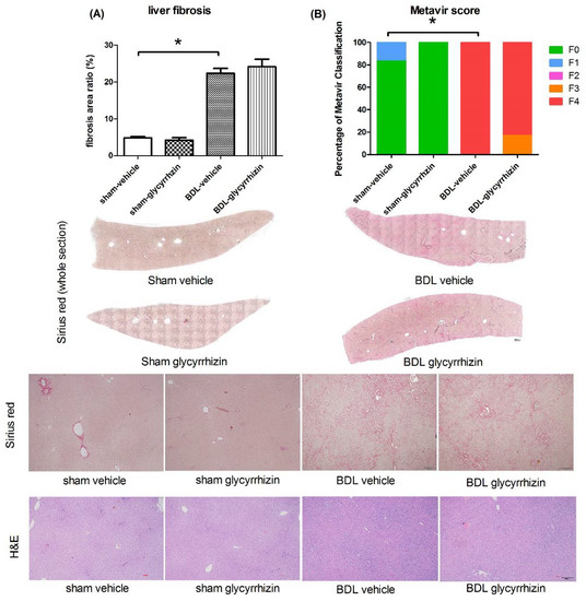 IJMS Free FullText Glycyrrhizin Attenuates Portal Hypertension and