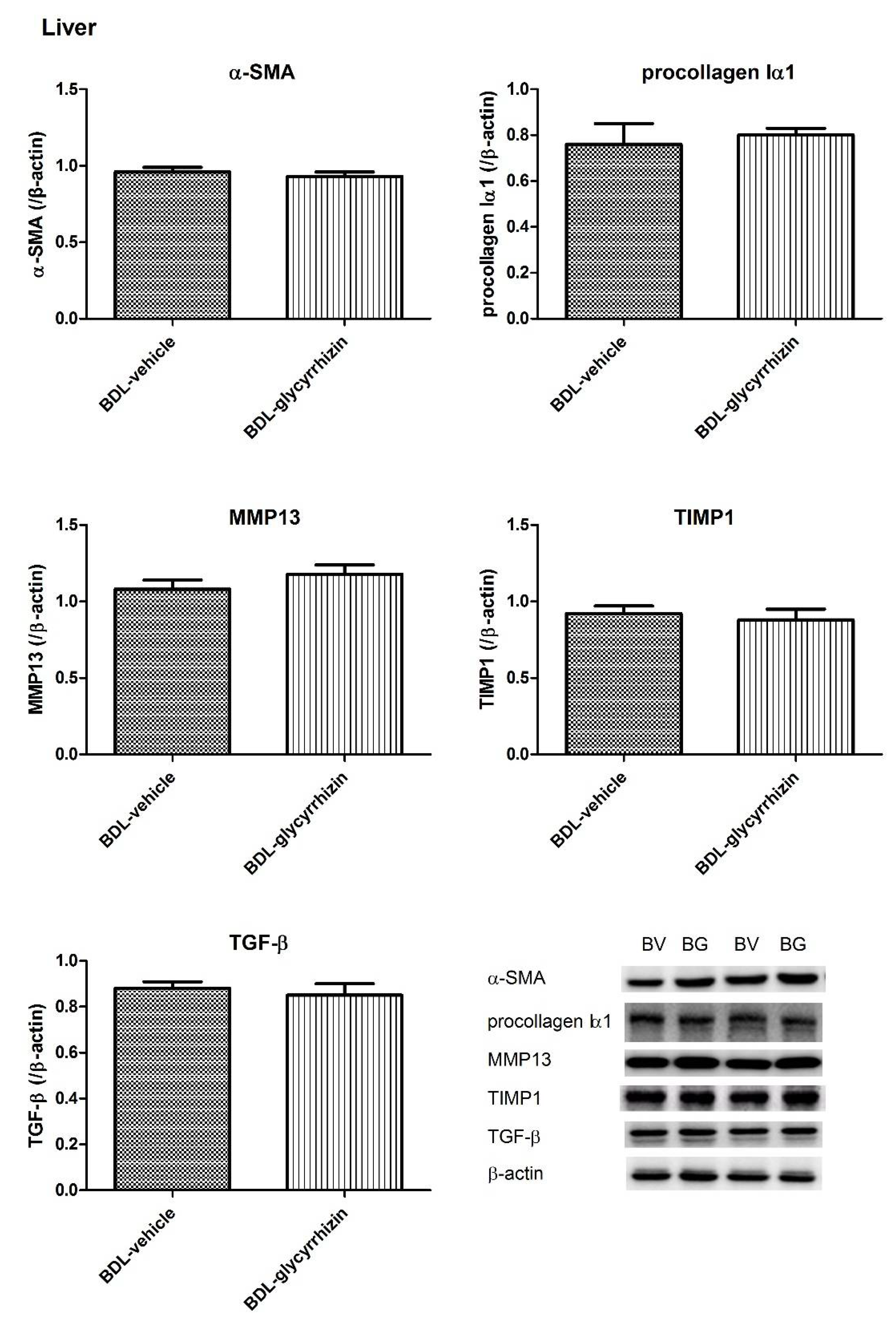 IJMS Free FullText Glycyrrhizin Attenuates Portal Hypertension and