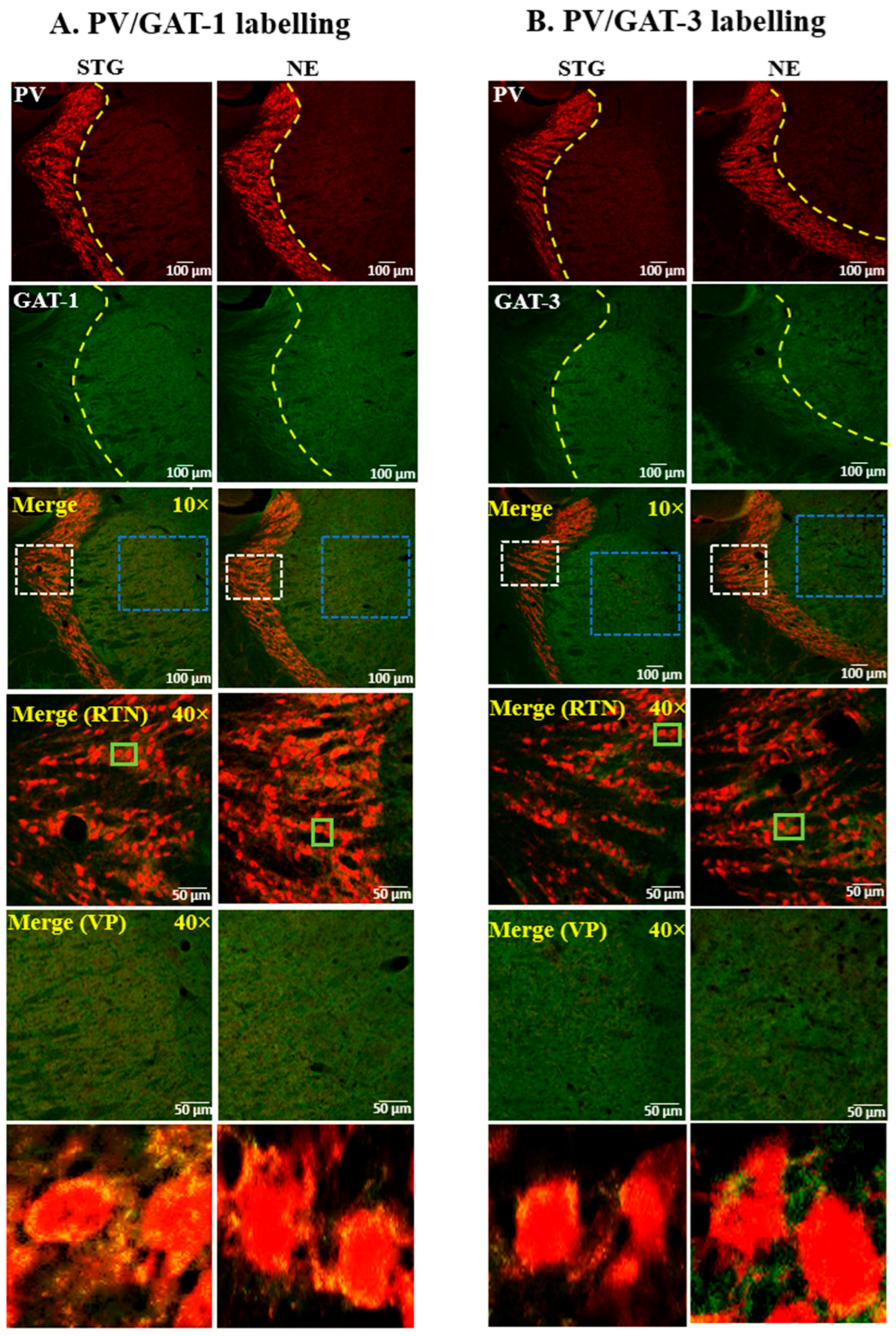 Ijms 22 07740 g004 550