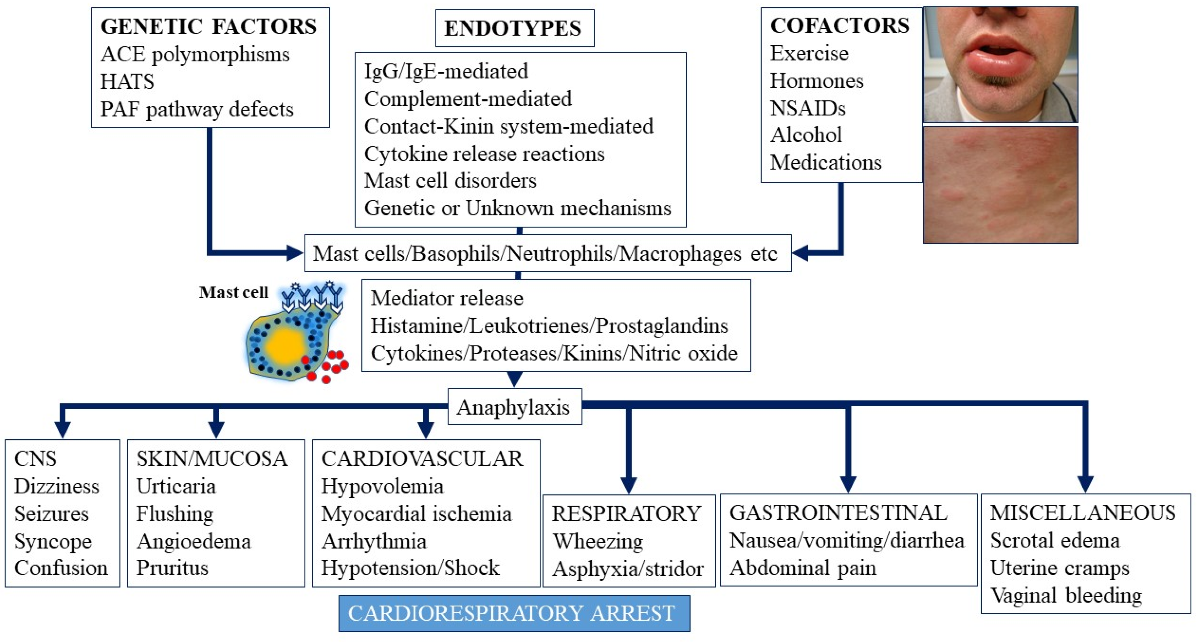 IJMS | Free Full-Text | Mechanisms Governing Anaphylaxis: Inflammatory  Cells, Mediators, Endothelial Gap Junctions and Beyond