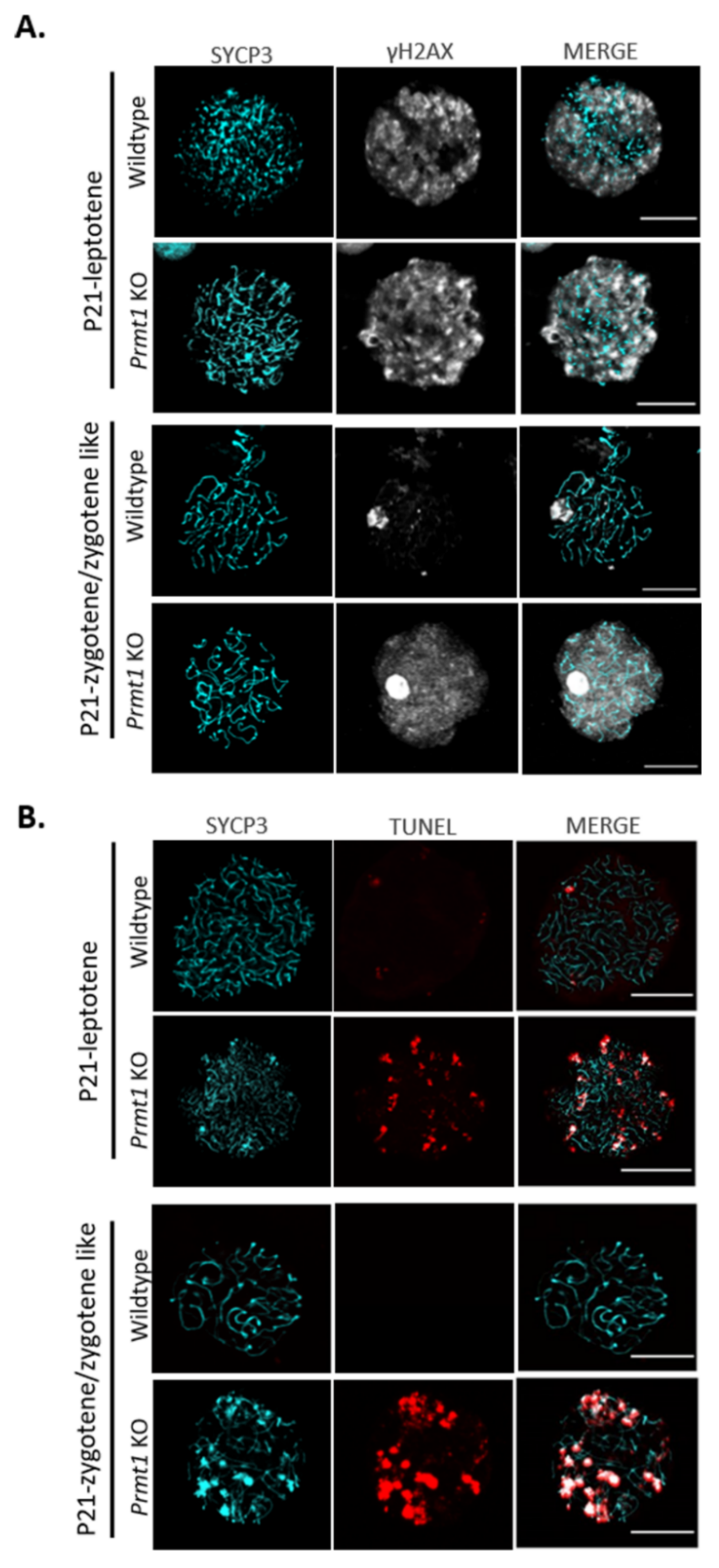 IJMS | Free Full-Text | Protein Arginine Methyltransferase 1 Is Essential  for the Meiosis of Male Germ Cells