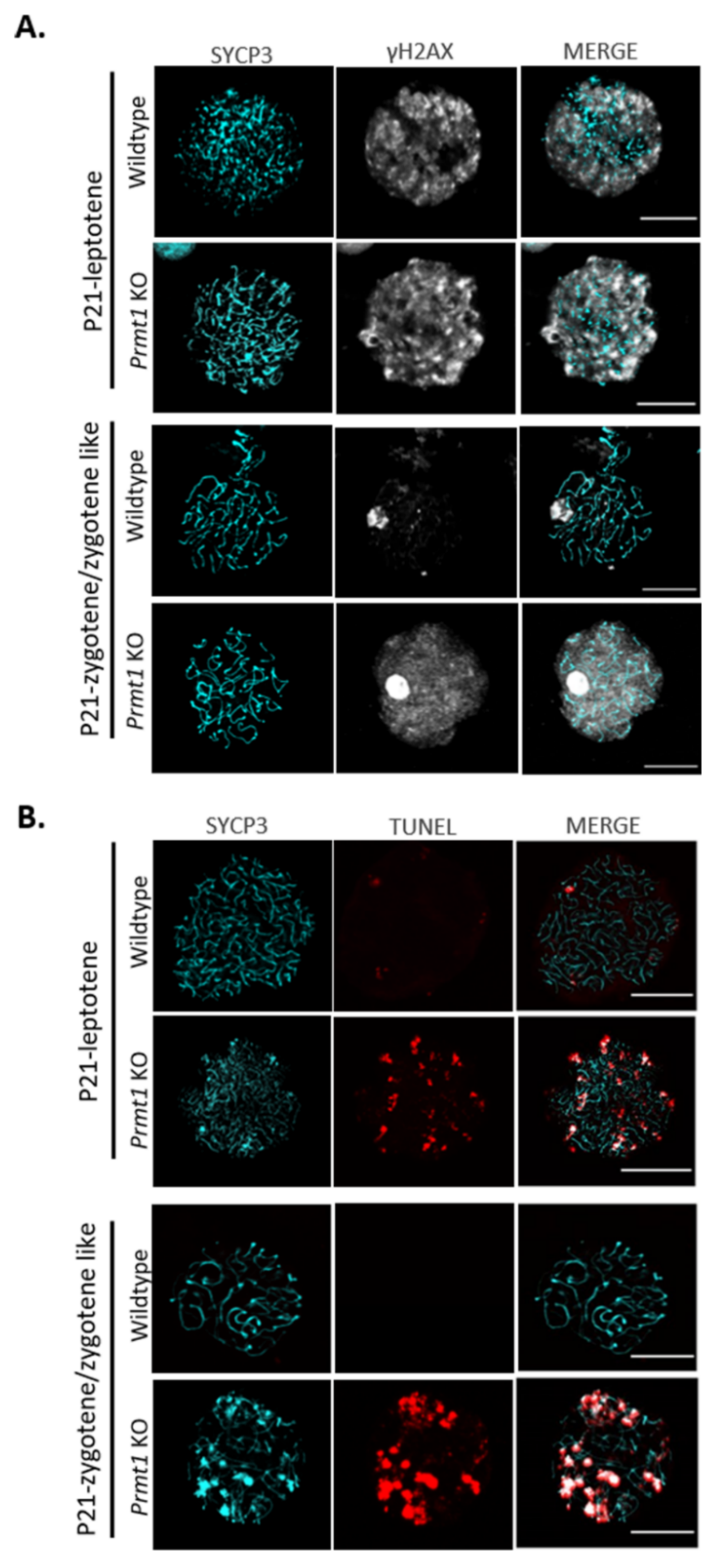 IJMS | Free Full-Text | Protein Arginine Methyltransferase 1 Is Essential for the Meiosis of Male Germ Cells IJMS | Free Full-Text | Protein Arginine Methyltransferase 1 Is Essential for the Meiosis of Male Germ Cells