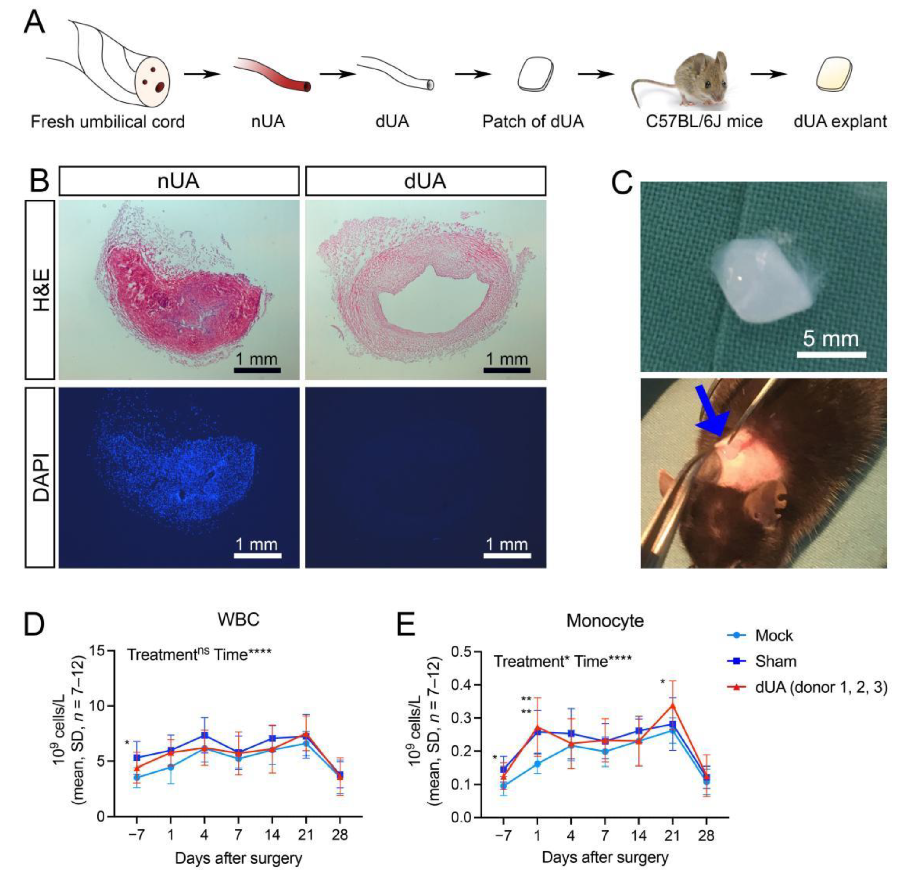 Ijms Free Full Text Decellularised Human Umbilical Artery As A Vascular Graft Elicits Minimal Pro Inflammatory Host Response Ex Vivo And In Vivo Ijms Free Full Text Decellularised Human Umbilical Artery As A Vascular Graft Elicits Minimal Pro Inflammatory Host Response Ex Vivo And In Vivo