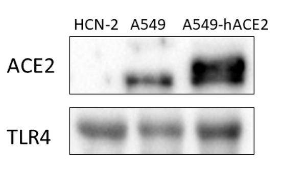 その他 A-49 A Review of Maricultural Wastewater Treatment Using an MBR