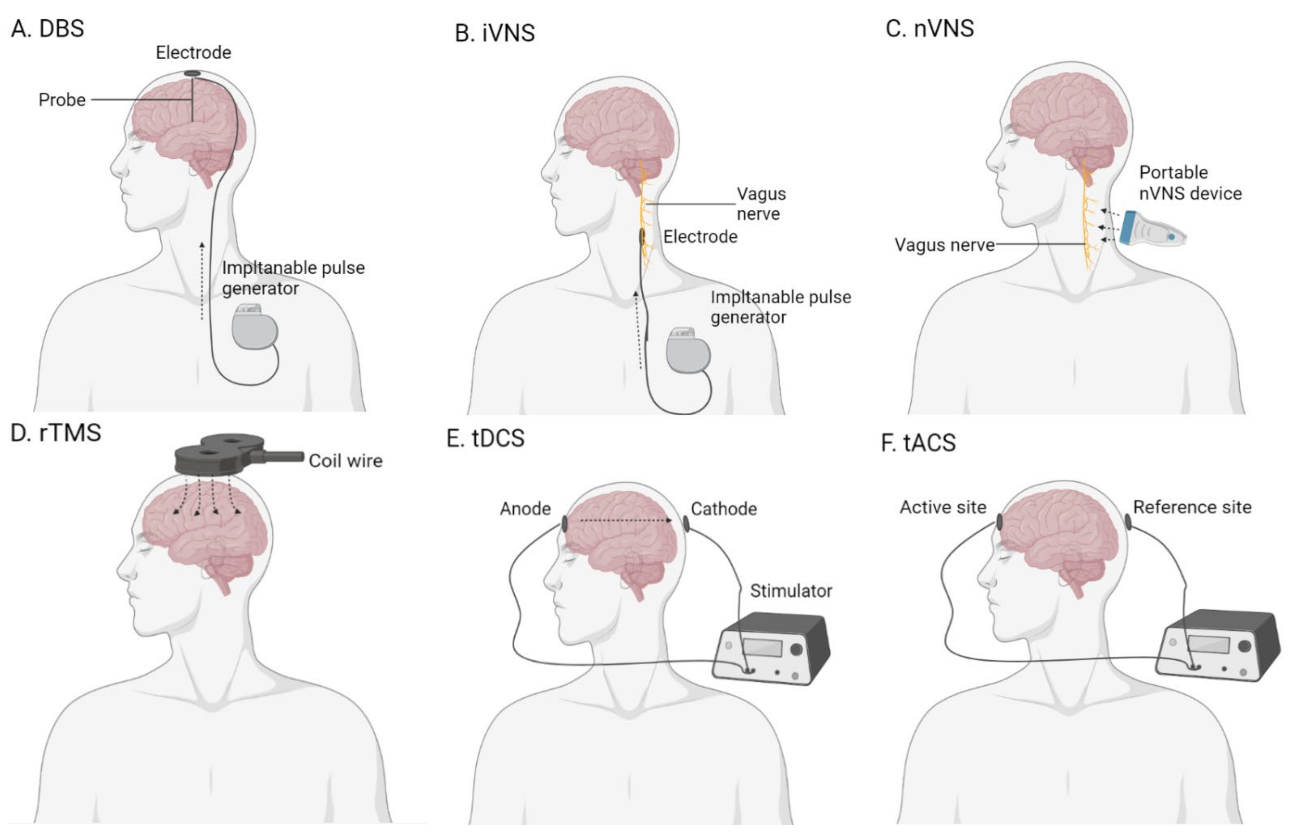 Novel Therapeutic Approaches for Alzheimer's Disease: An