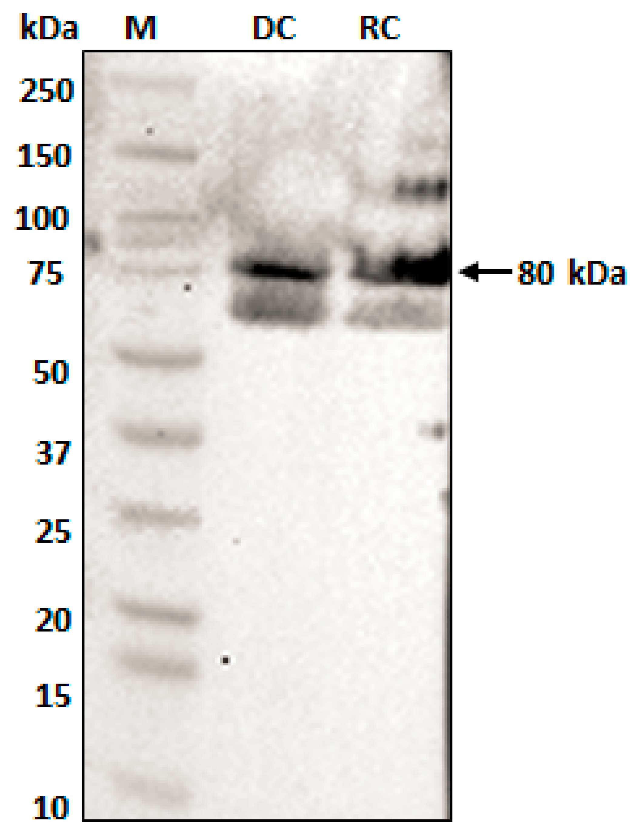 Ijms 22 08420 g006 Ijms 22 08420 g006
