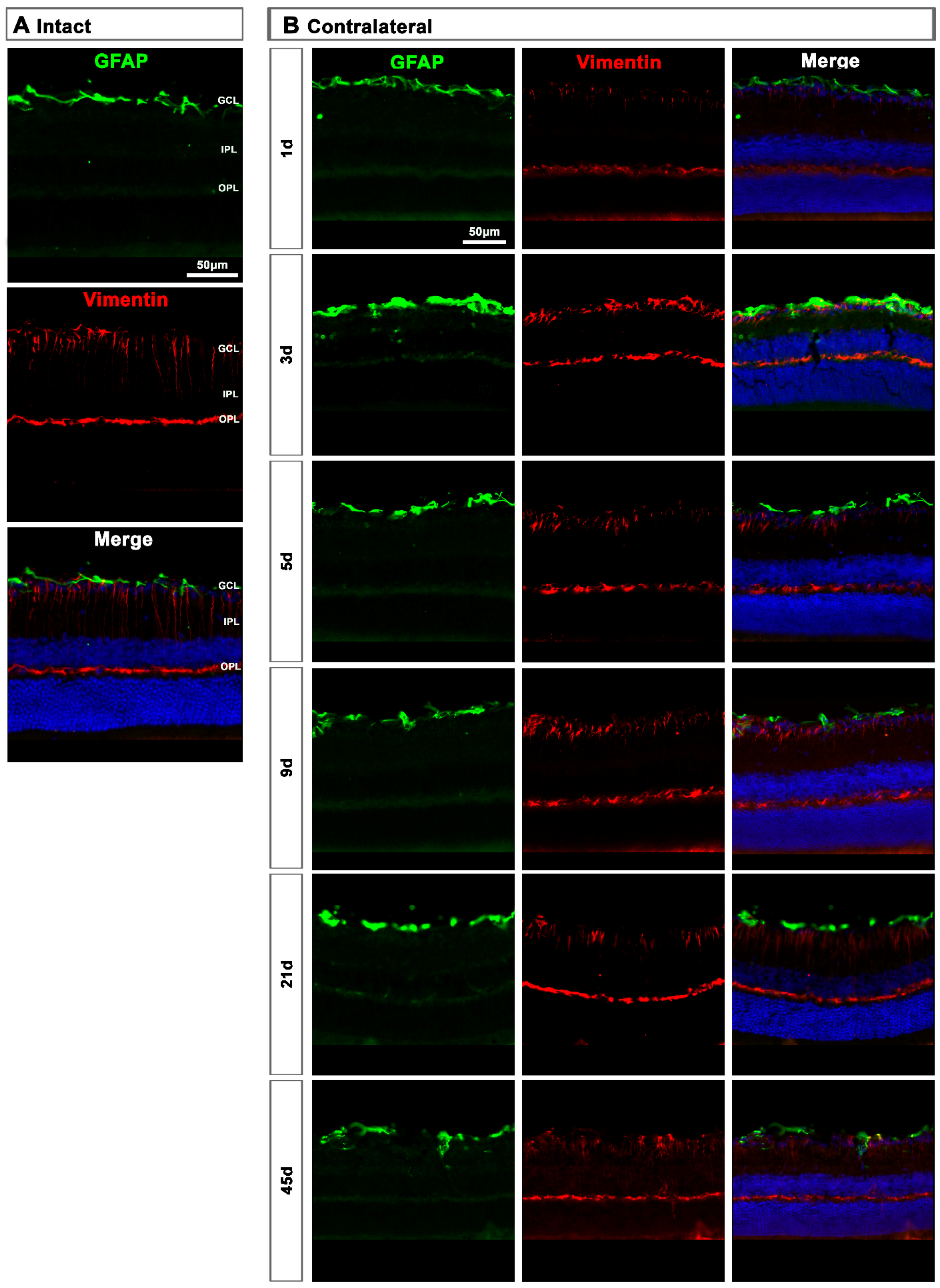 Ijms 22 08517 g009 550