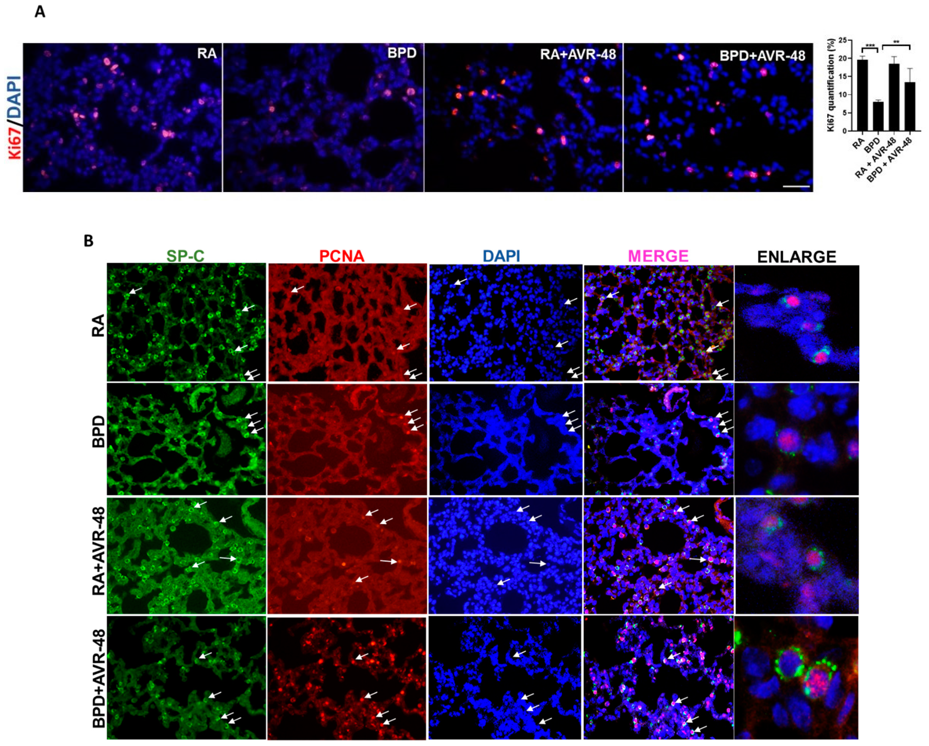 Ijms 22 08547 g004a Ijms 22 08547 g004a