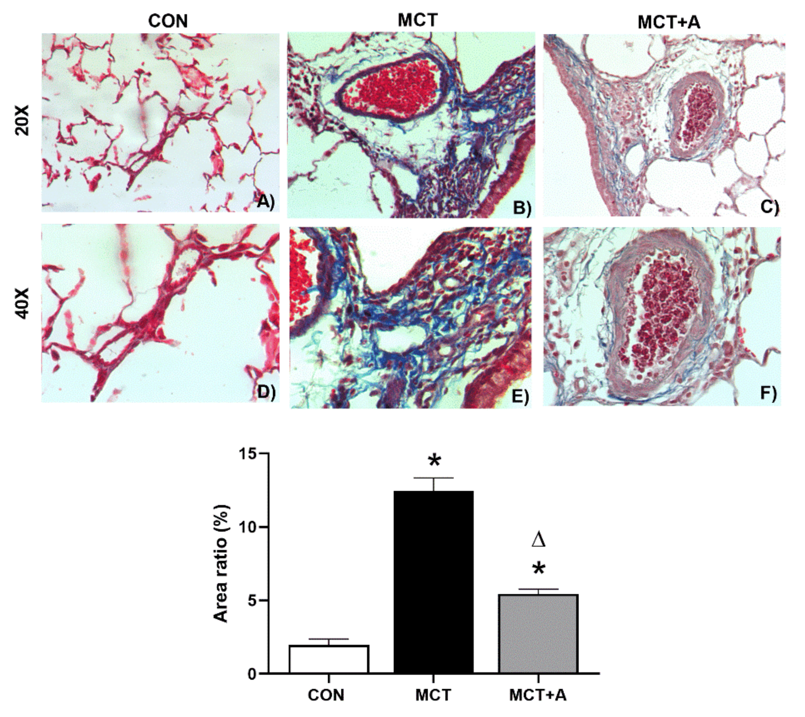 Ijms 22 08600 g005 550