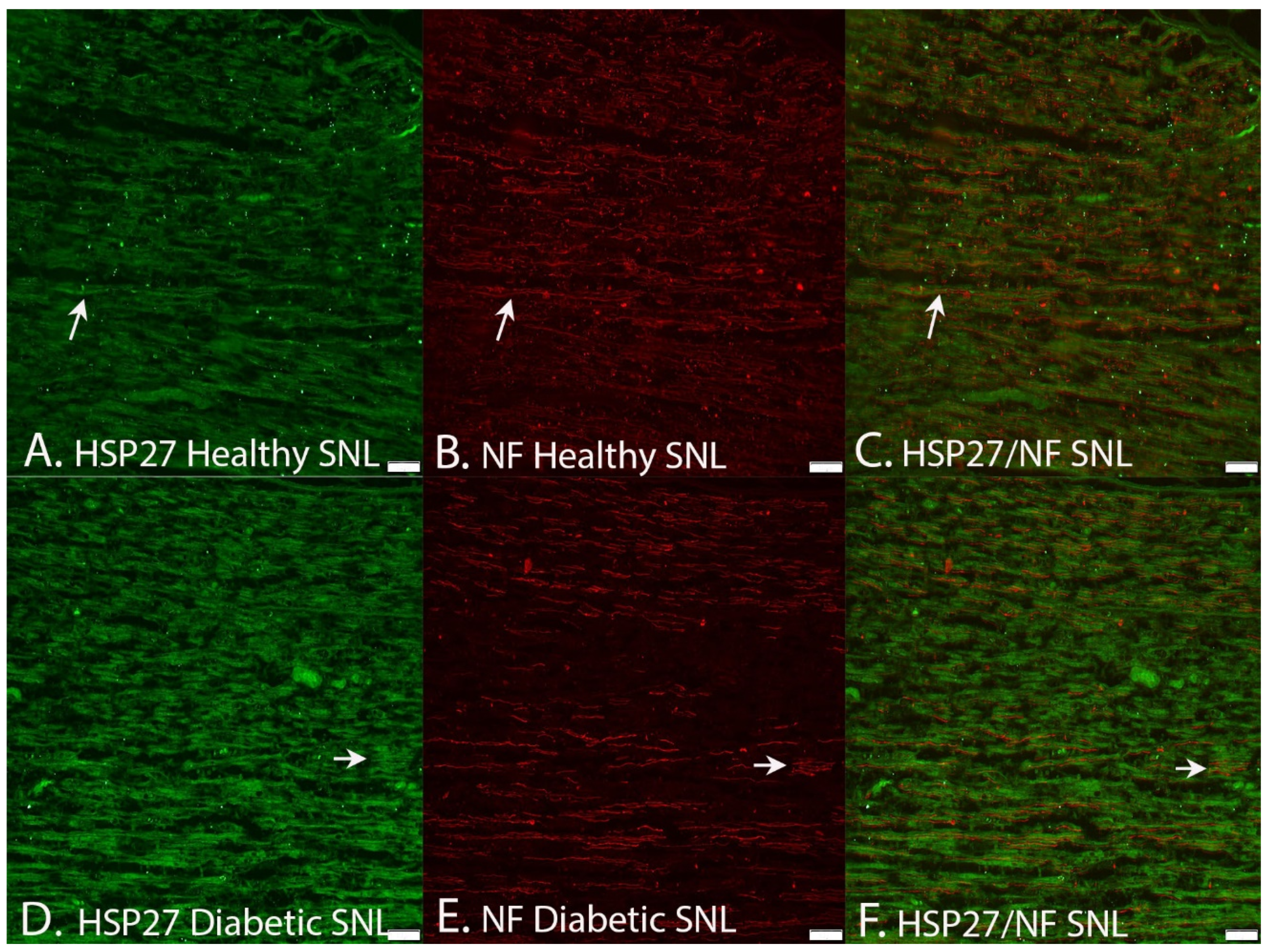 Ijms 22 08624 g008 Ijms 22 08624 g008