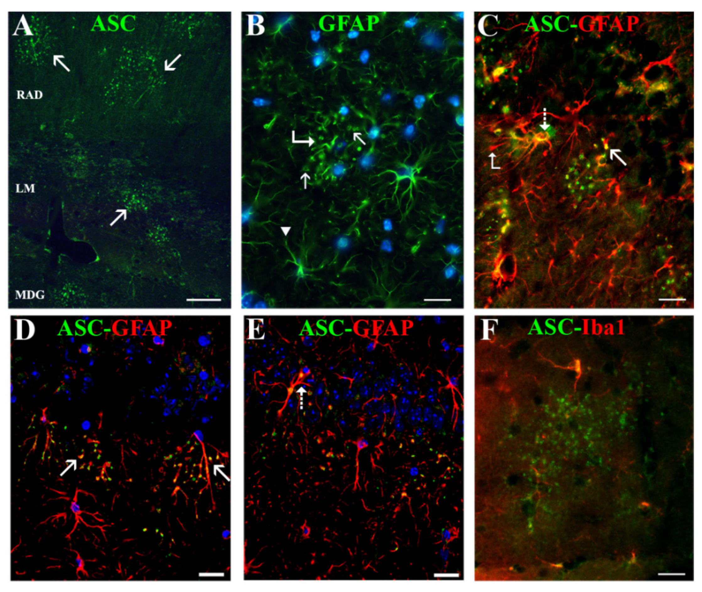 Ijms 22 08697 g004 550