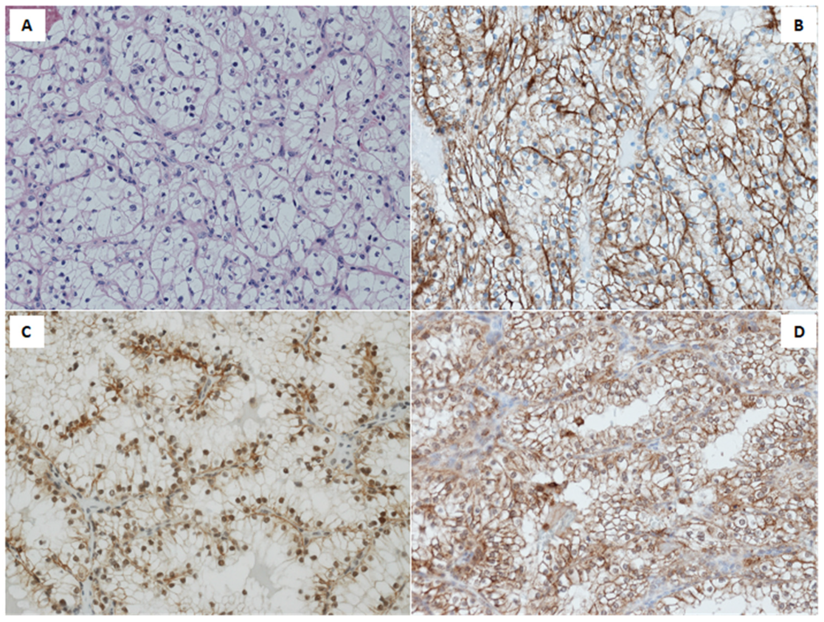 Ijms 22 08747 g001 550