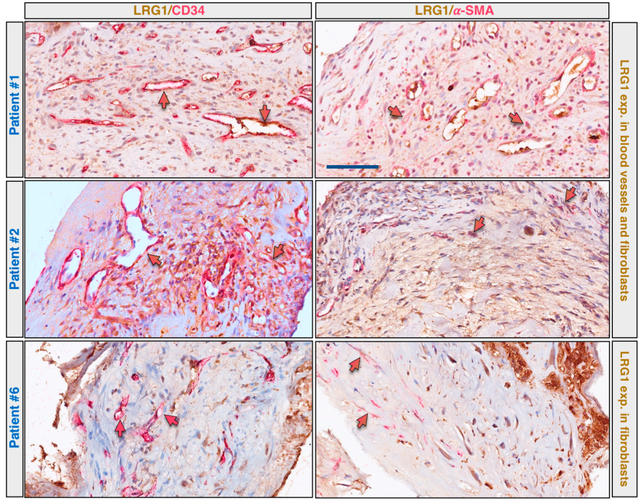 Ijms 22 08879 g003 550