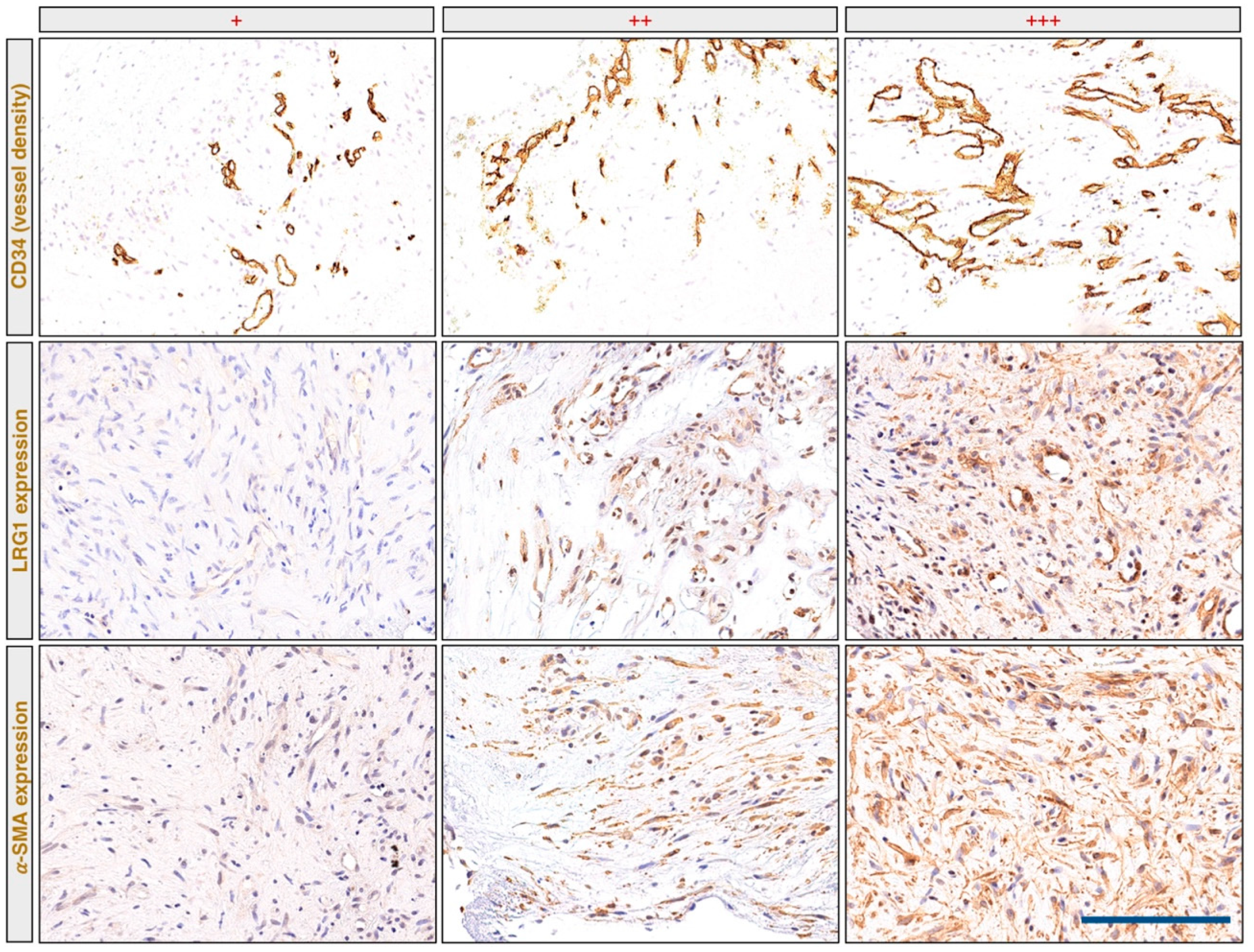 Ijms 22 08879 g0a2 550