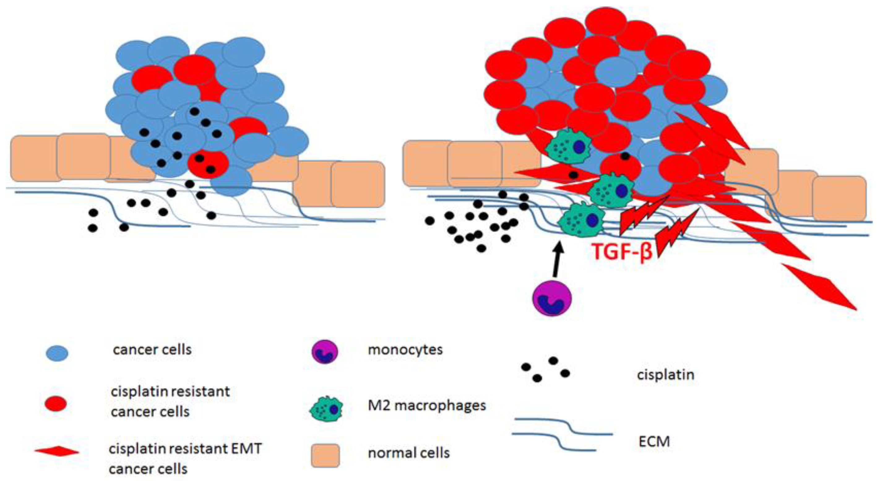 Why a Common Cancer Drug May Damage Your Ears - Helping Me Hear