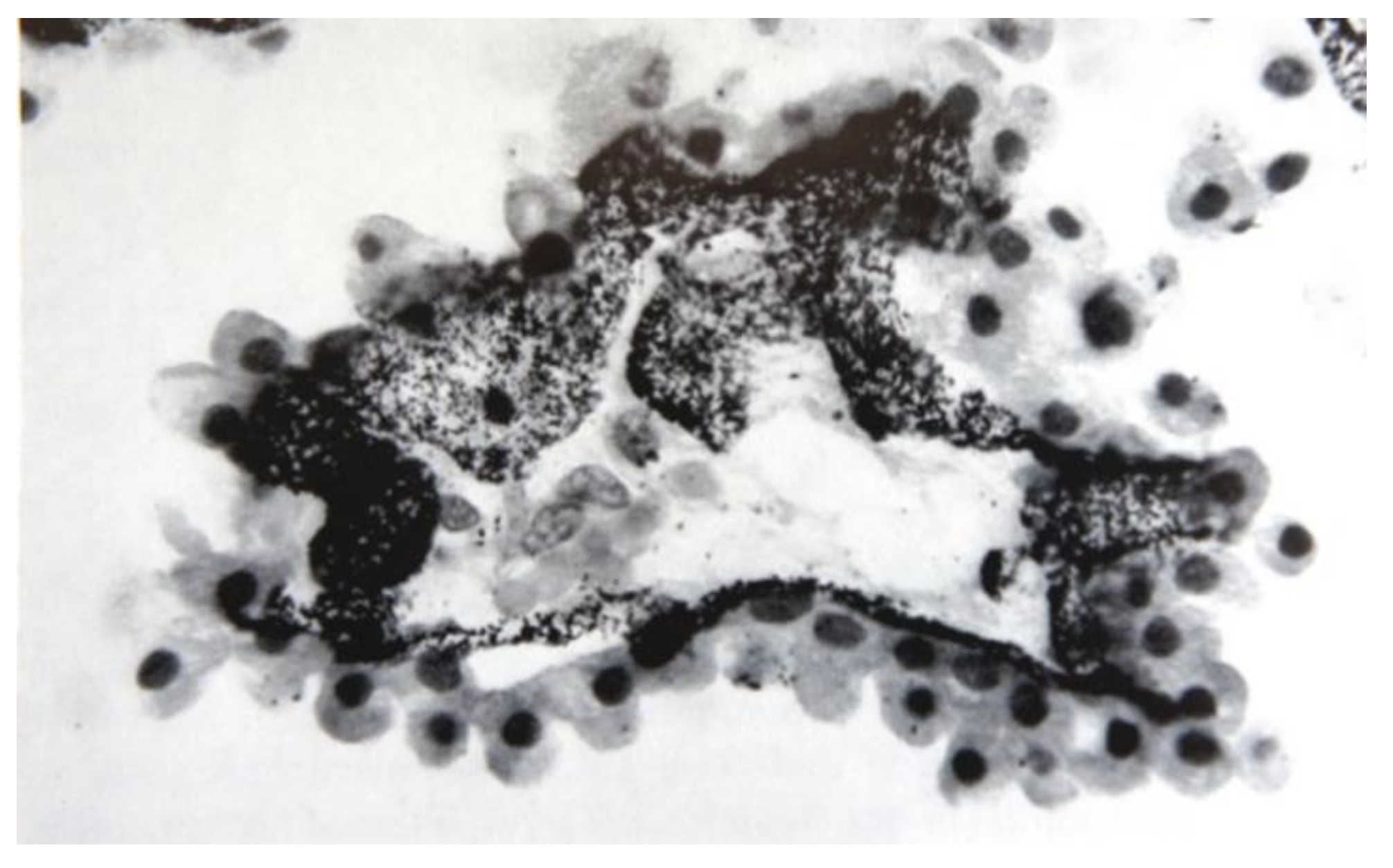 Ijms 22 08932 g004 550