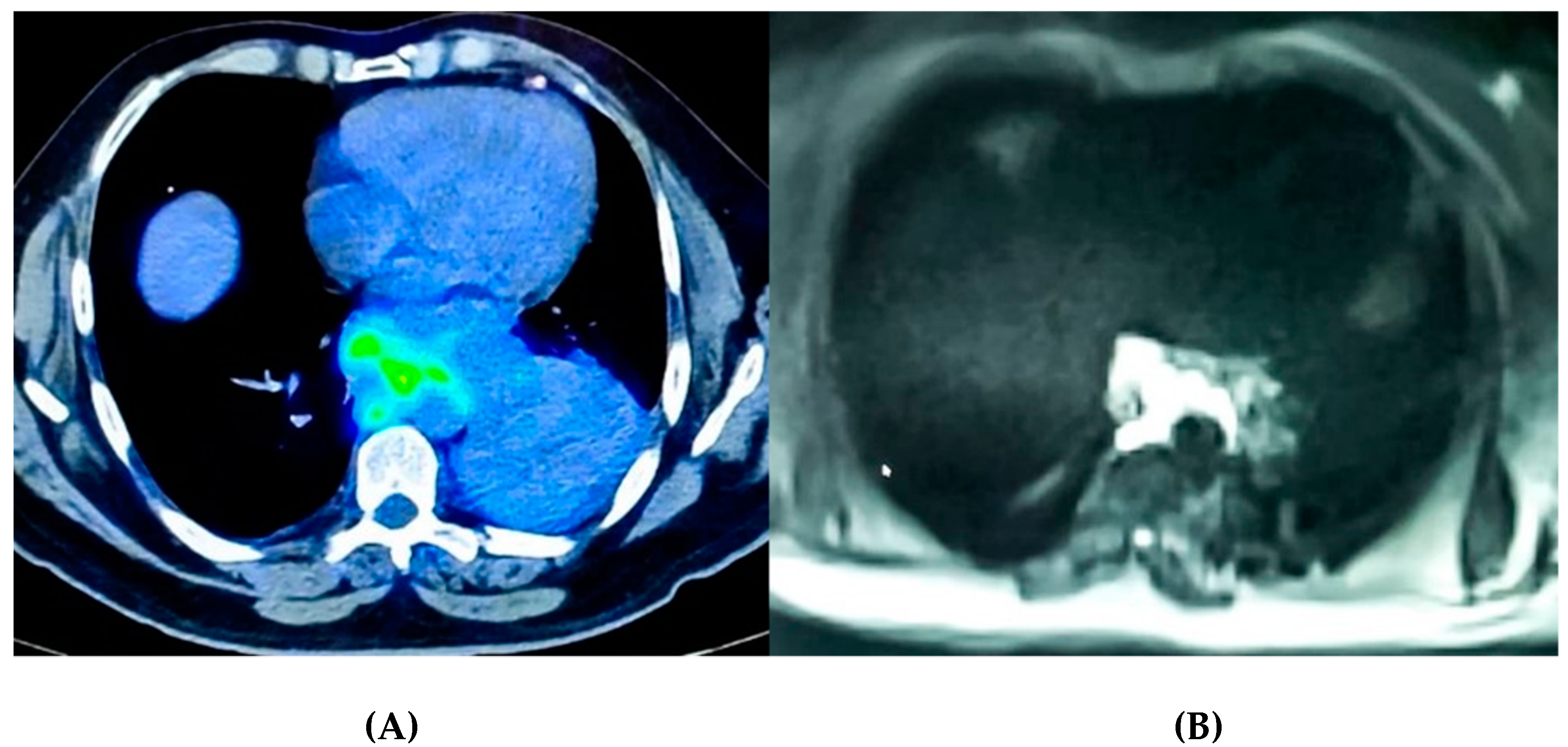 Ijms 22 09014 g002 Ijms 22 09014 g002