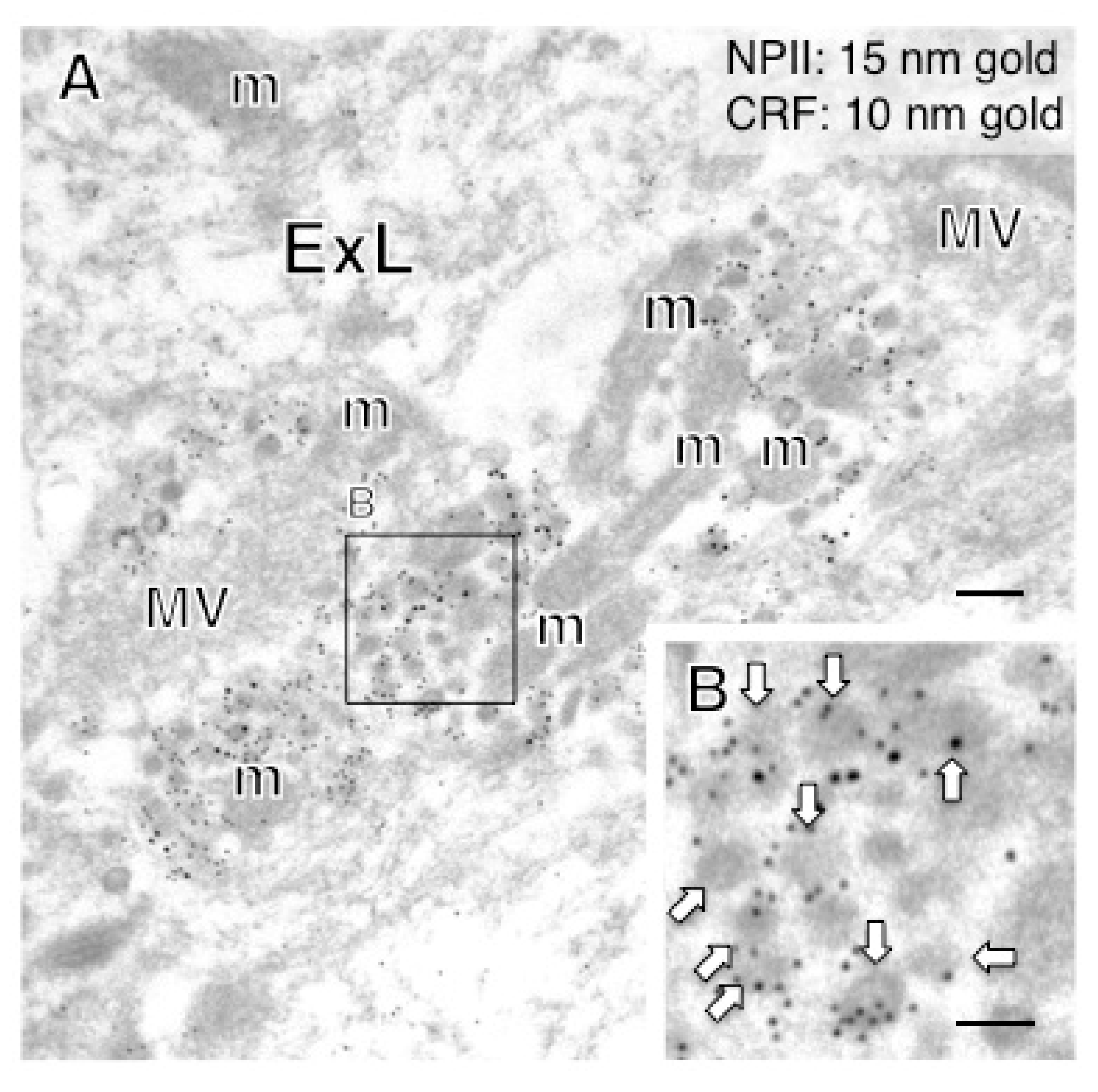 Ijms 22 09180 g010 550